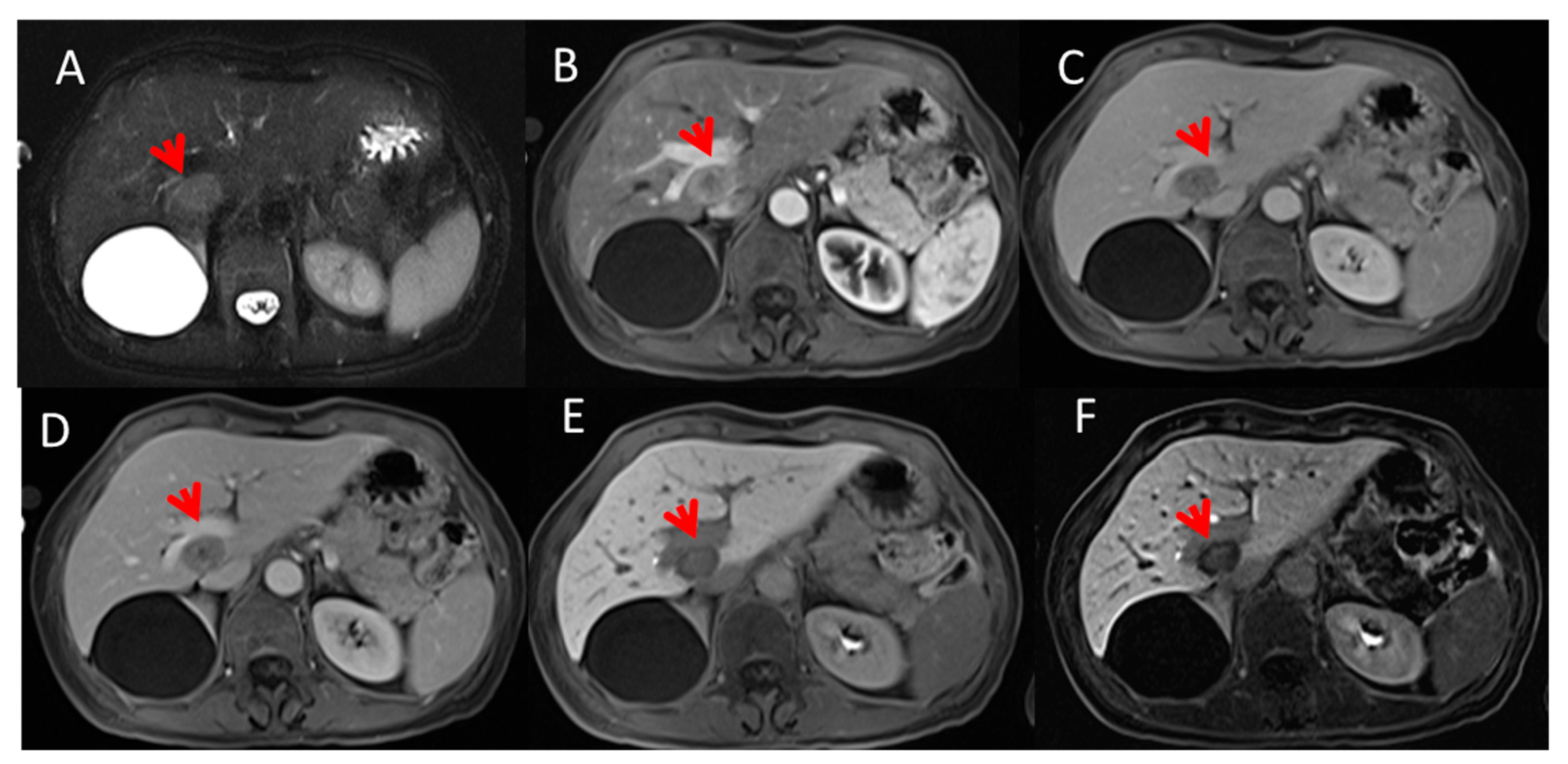 Cancers 13 00453 g001