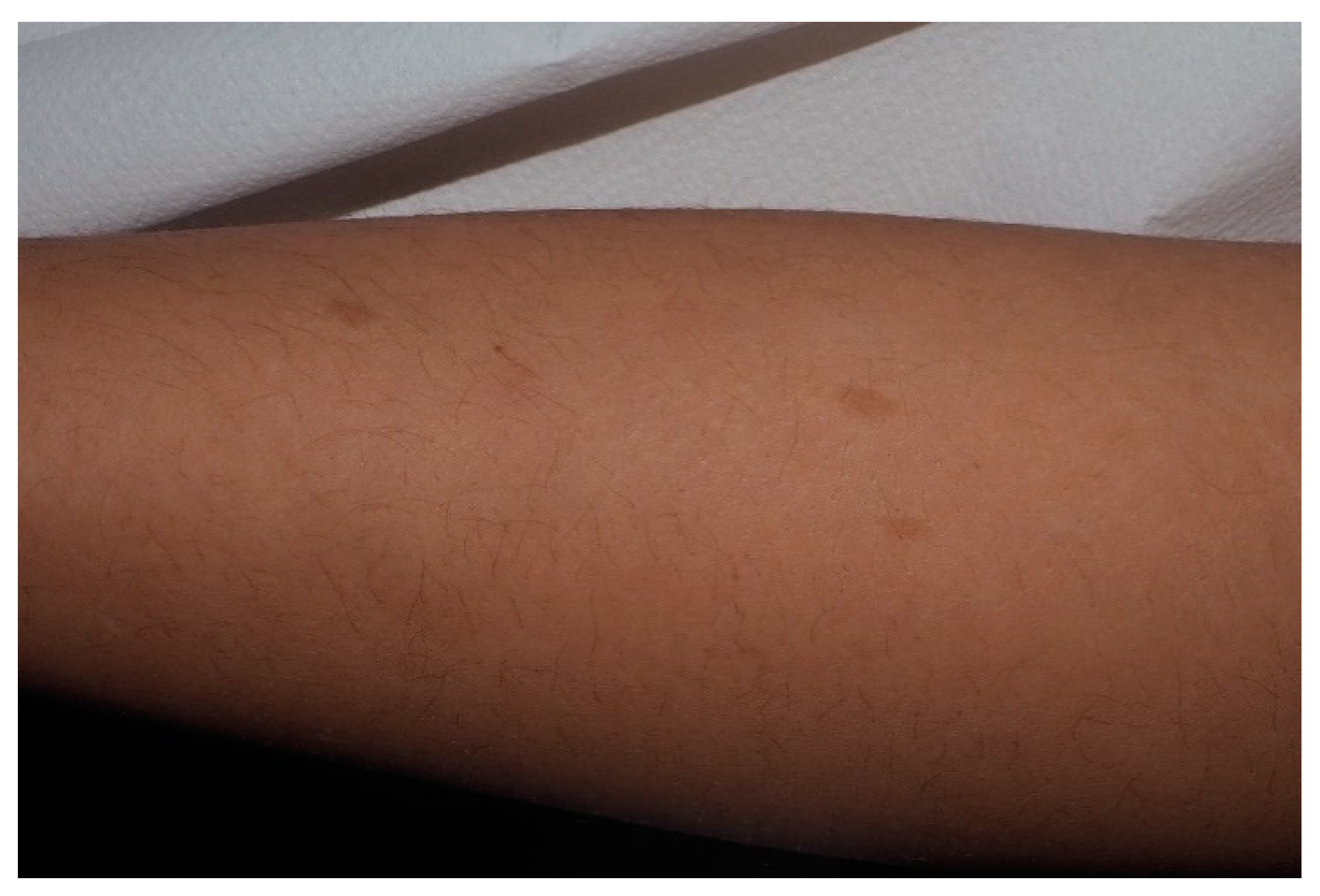 Cancers 13 00463 g003 Cancers 13 00463 g003