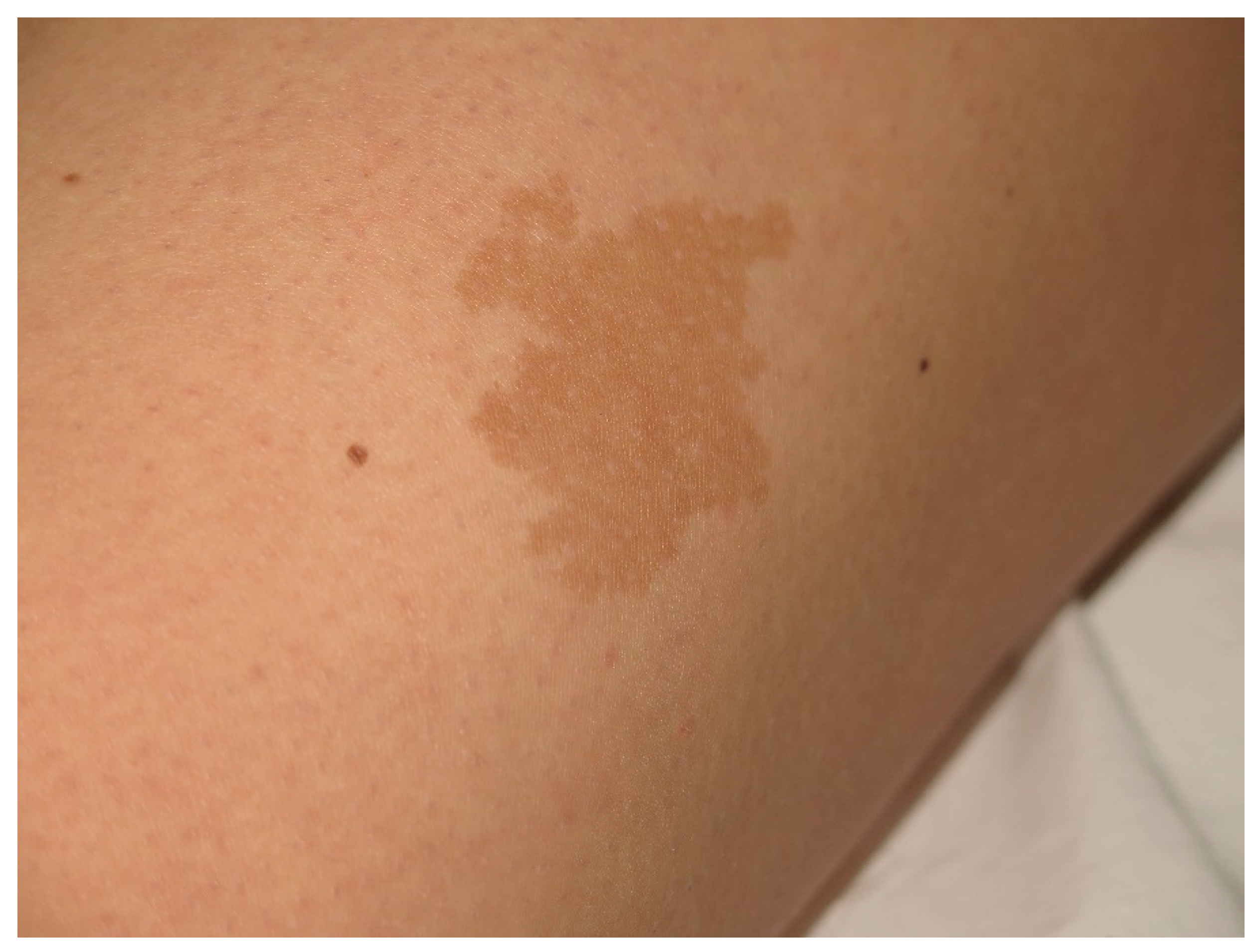 Cancers 13 00463 g004 Cancers 13 00463 g004