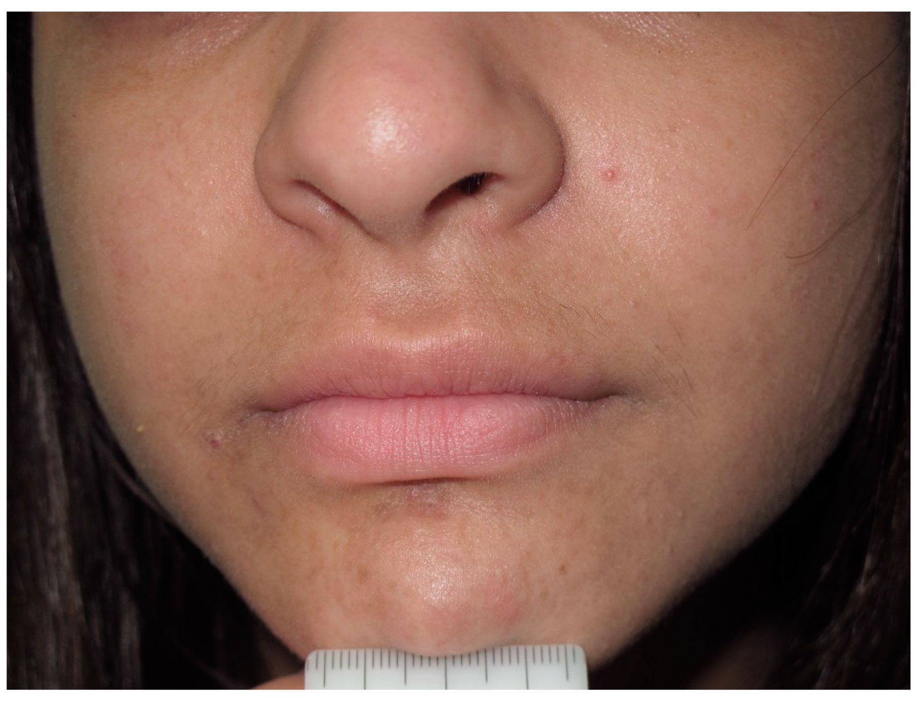 Cancers 13 00463 g008 Cancers 13 00463 g008