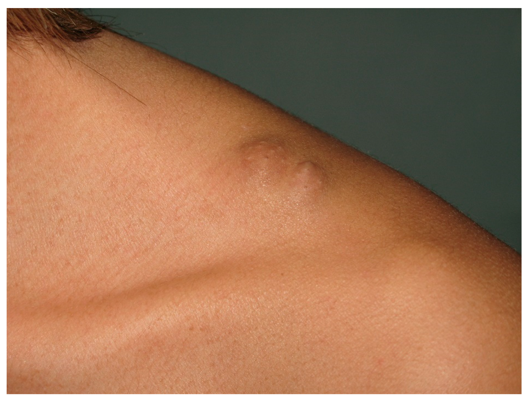 Cancers 13 00463 g009 Cancers 13 00463 g009