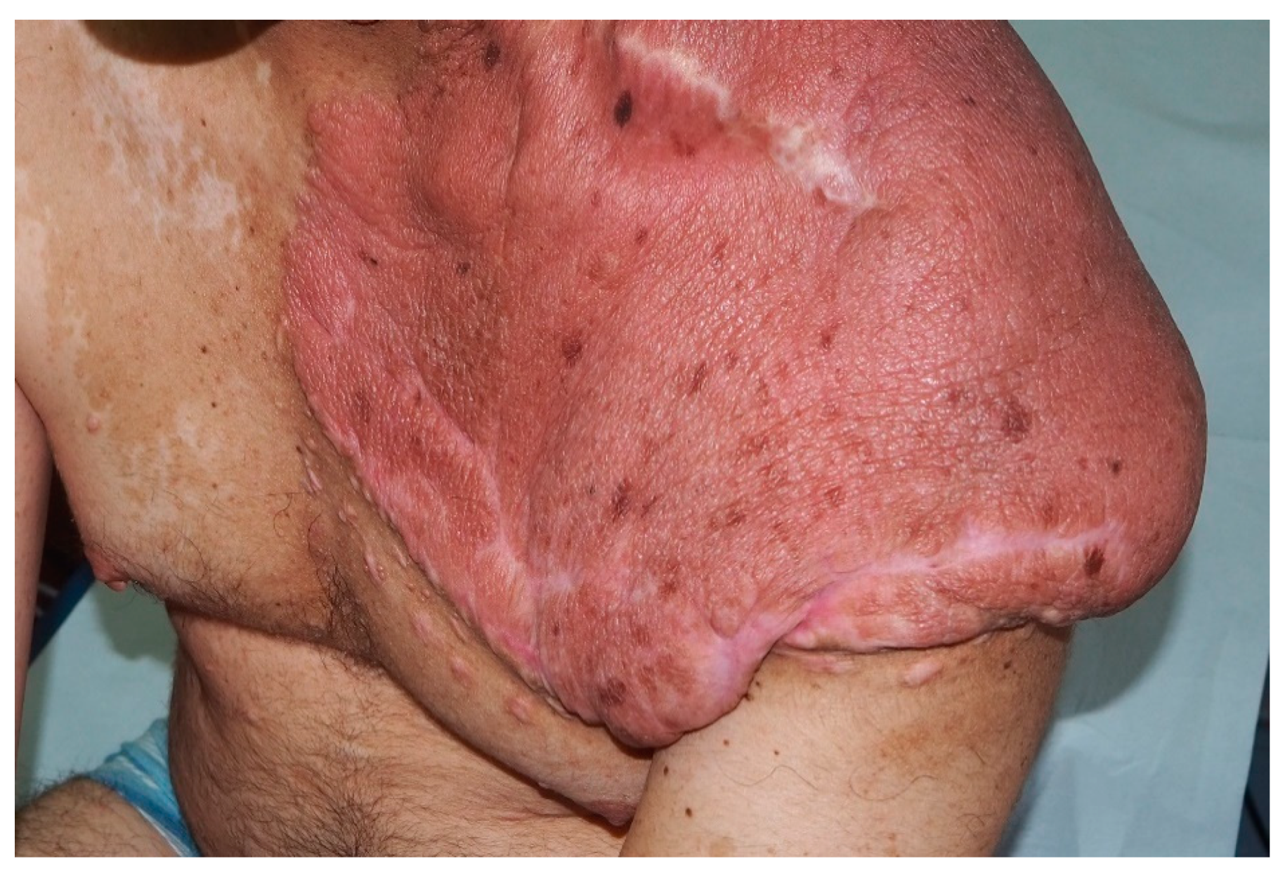 Cancers 13 00463 g011 Cancers 13 00463 g011