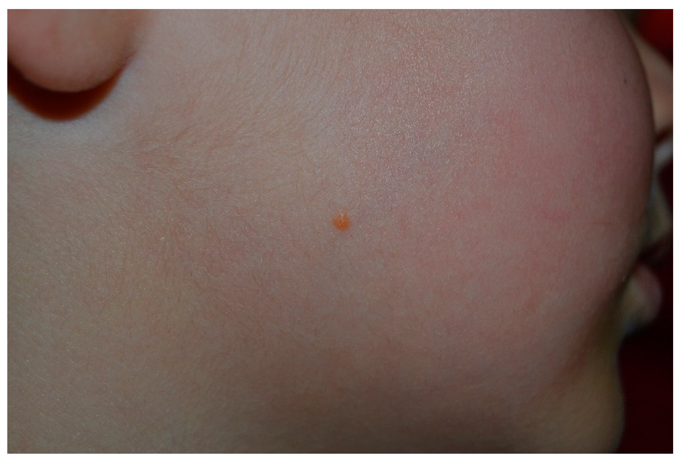 Cancers 13 00463 g013 Cancers 13 00463 g013