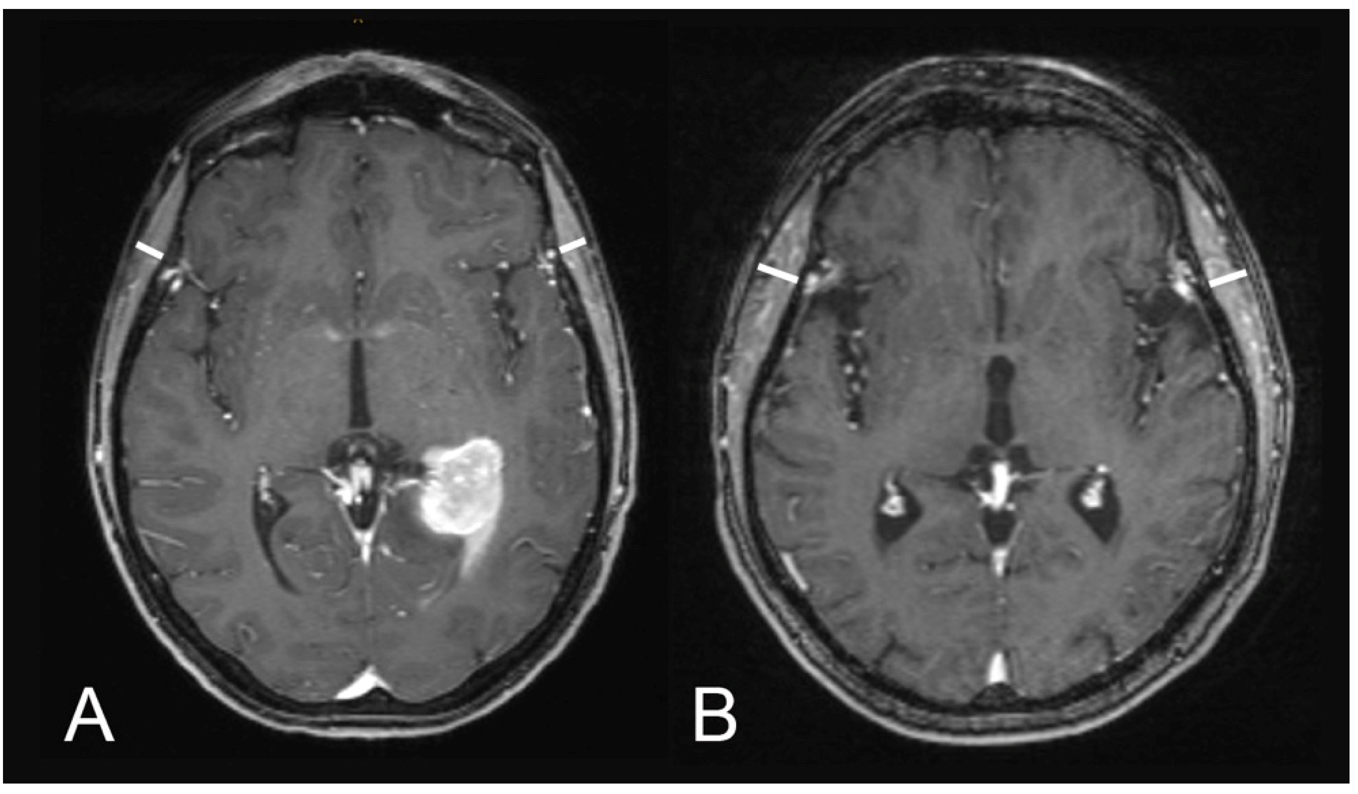 Cancers 13 00566 g001