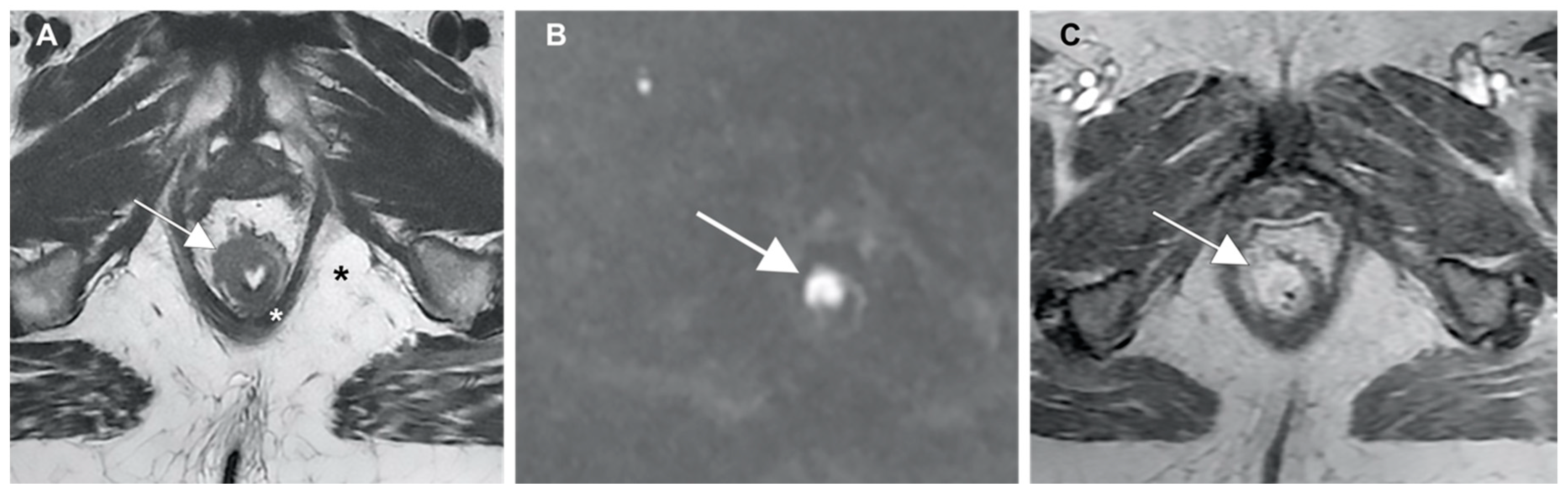 Cancers 13 00574 g003