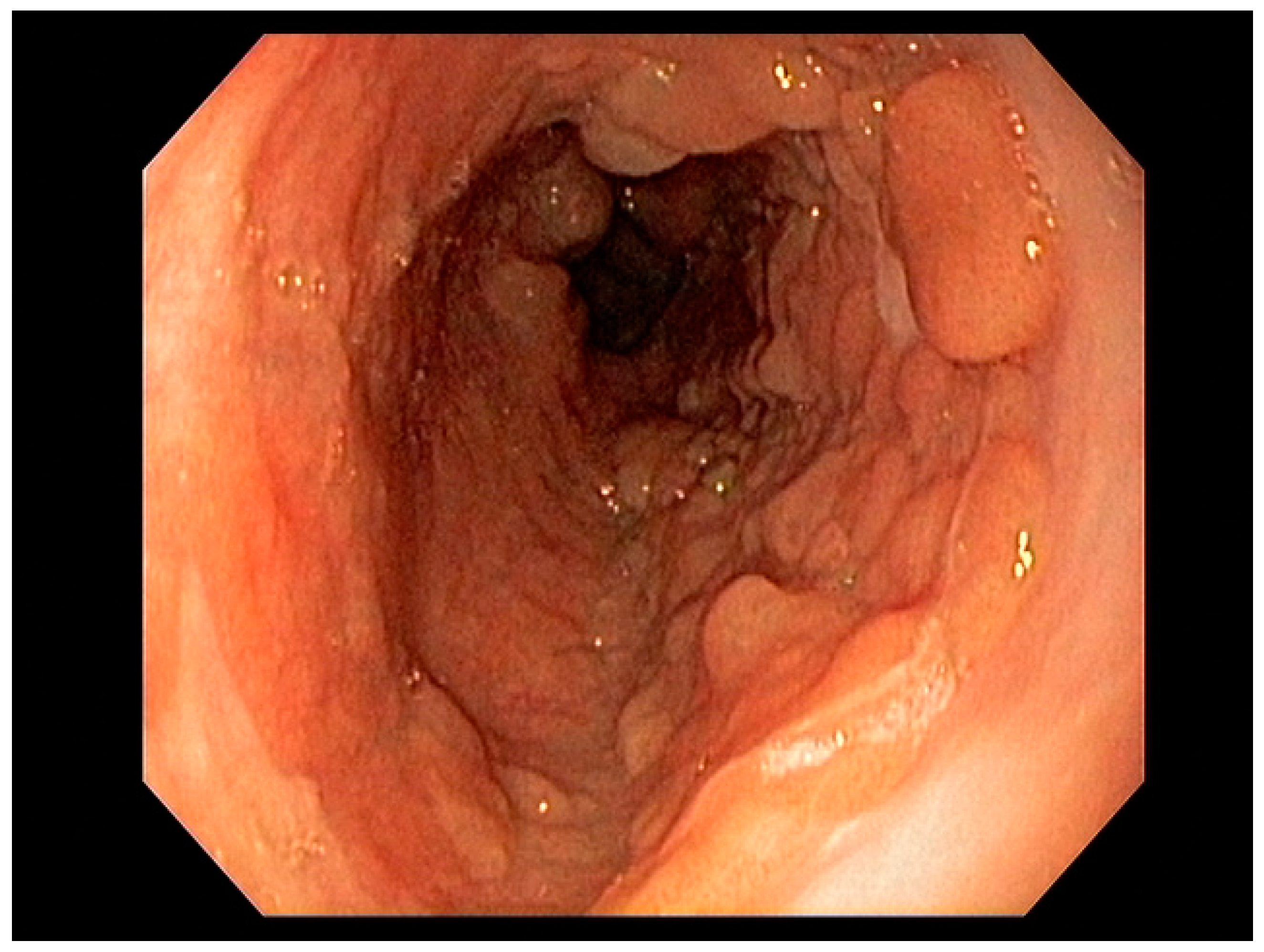 Cancers 13 00582 g001