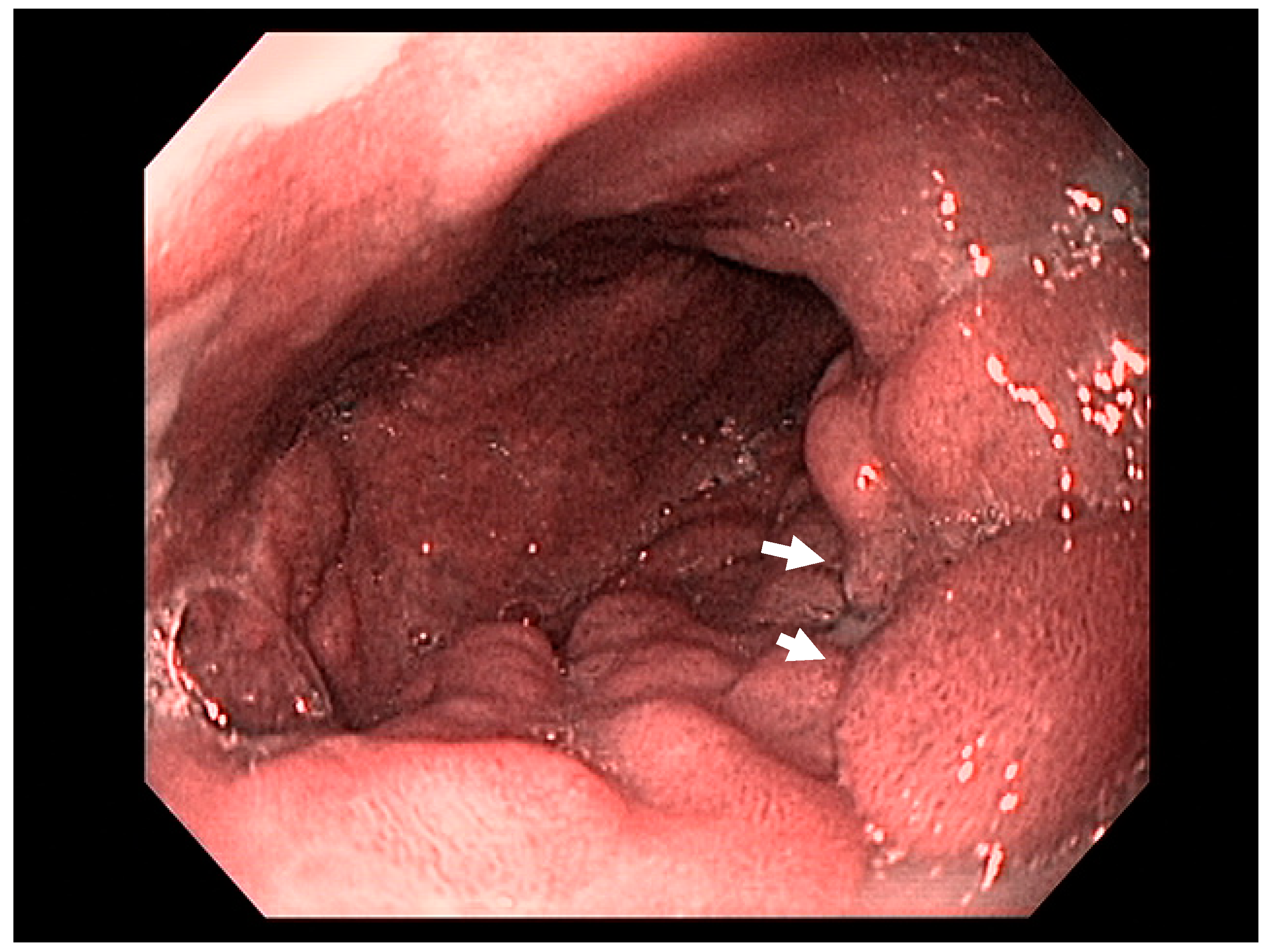 Cancers 13 00582 g002