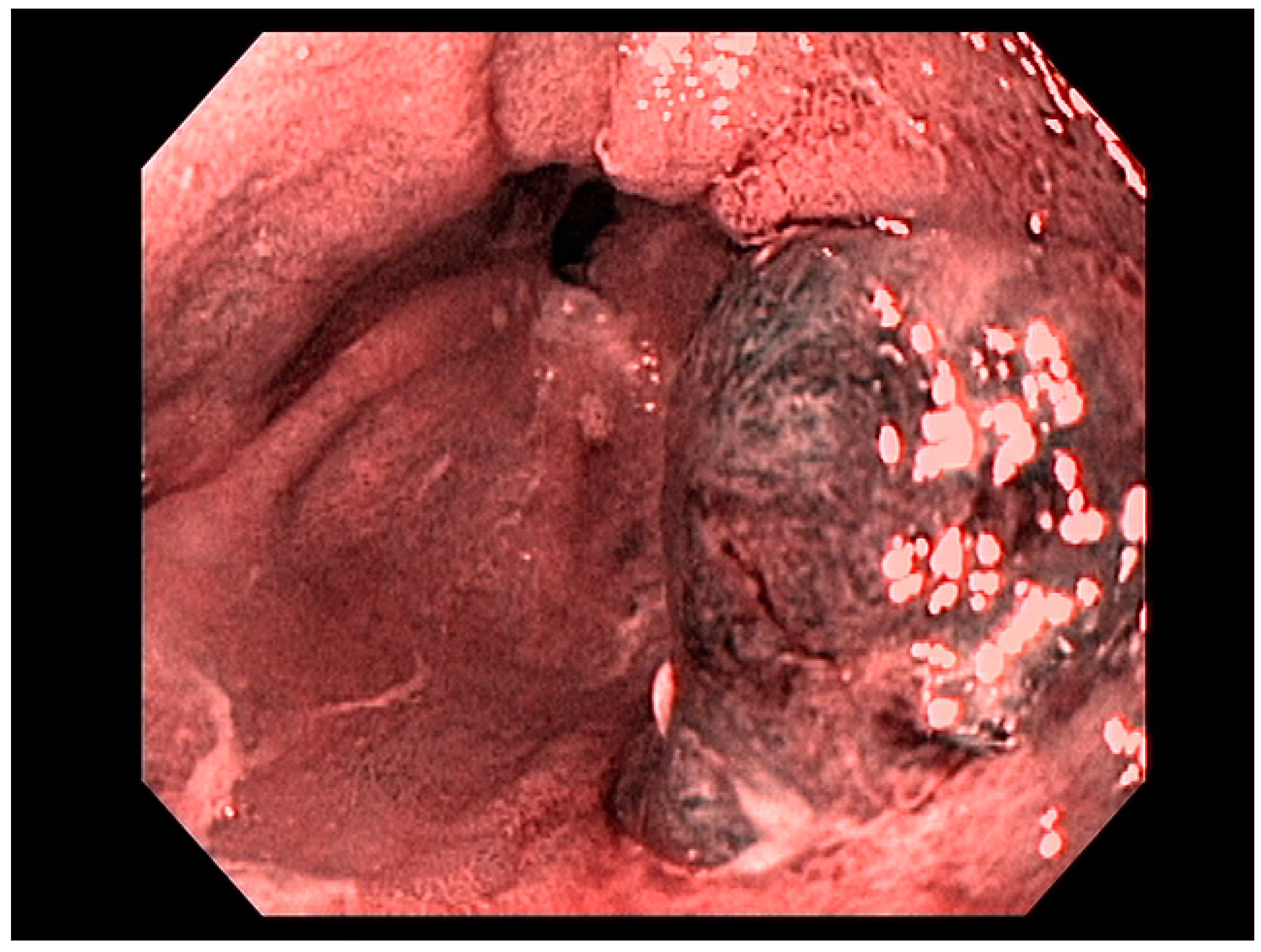 Cancers 13 00582 g003