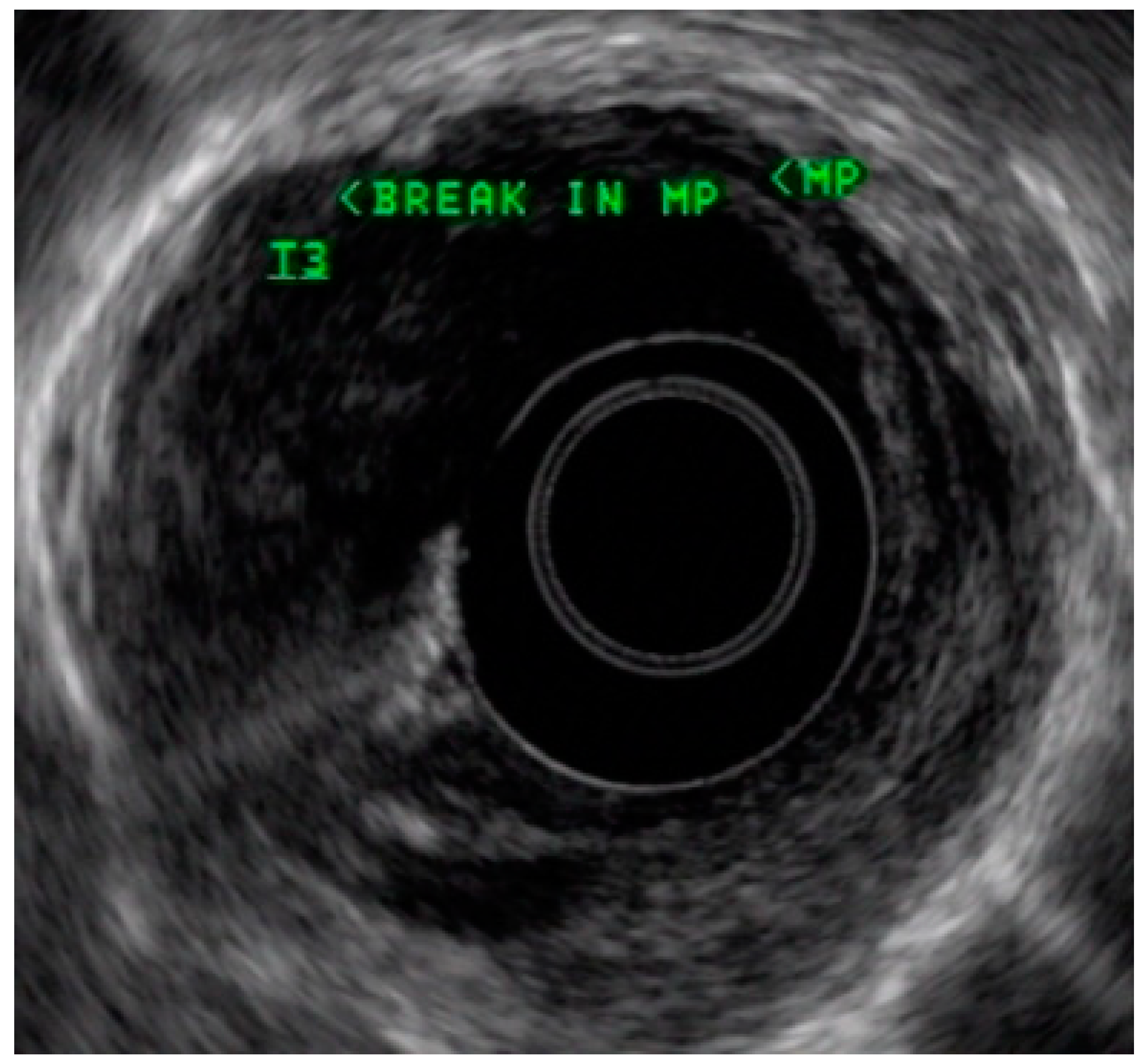 Cancers 13 00582 g004