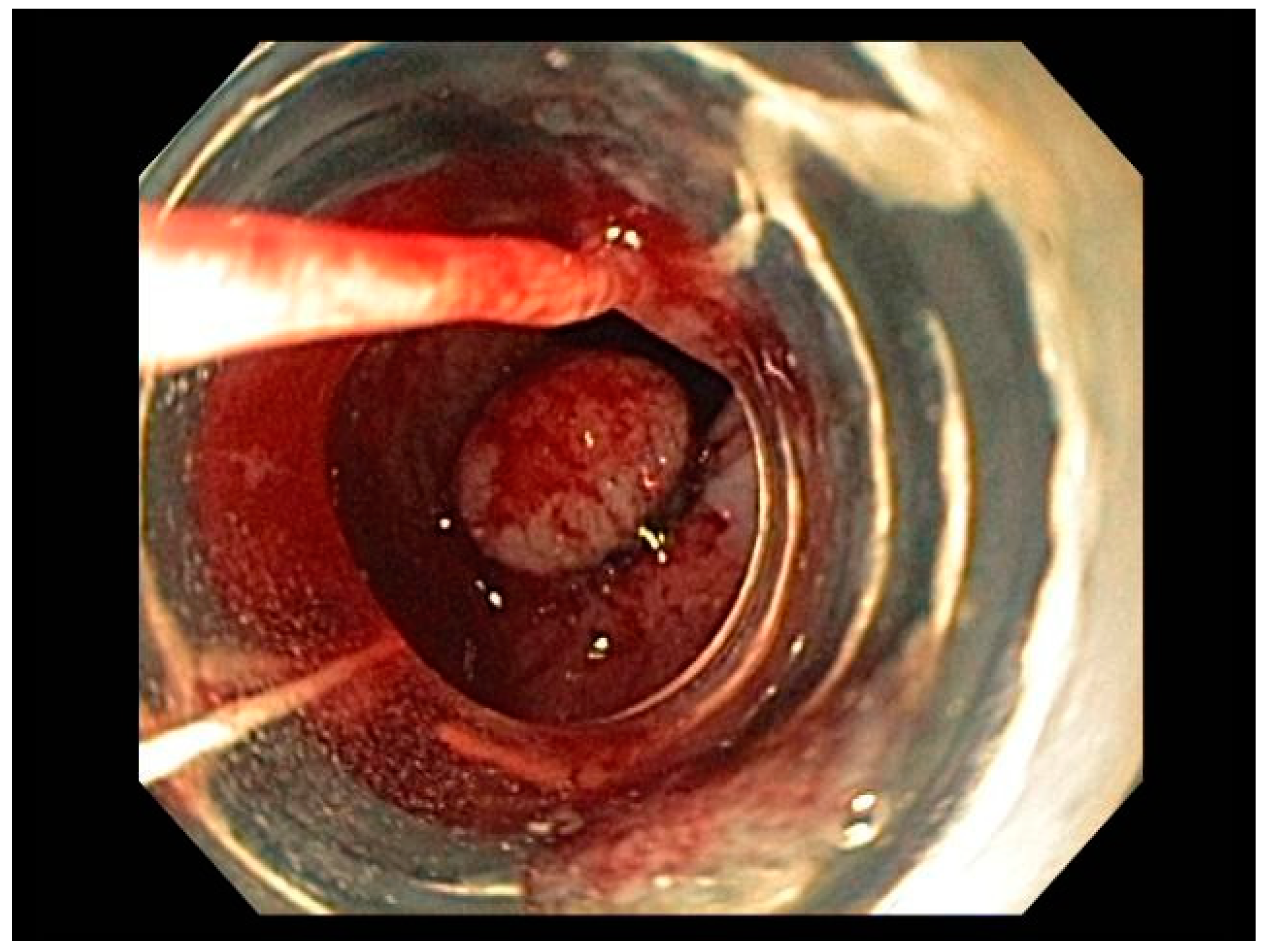 Cancers 13 00582 g005