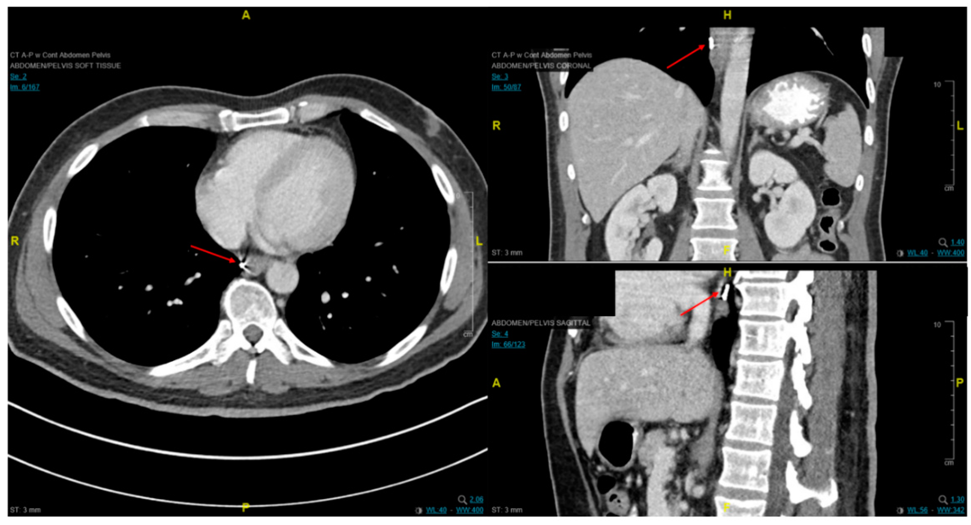 Cancers 13 00582 g007