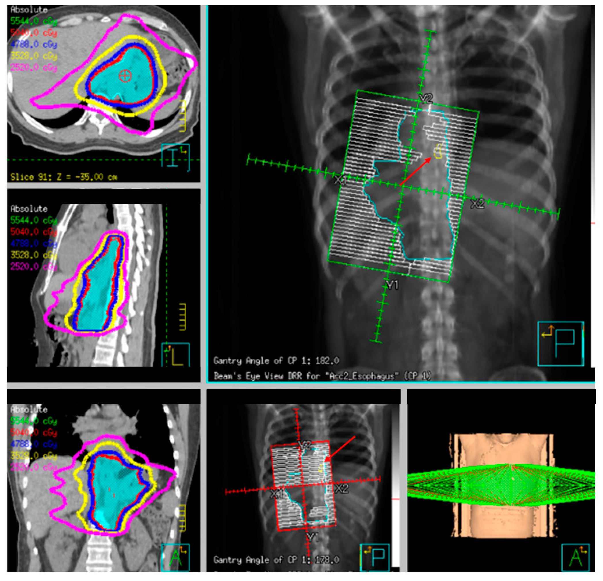 Cancers 13 00582 g008