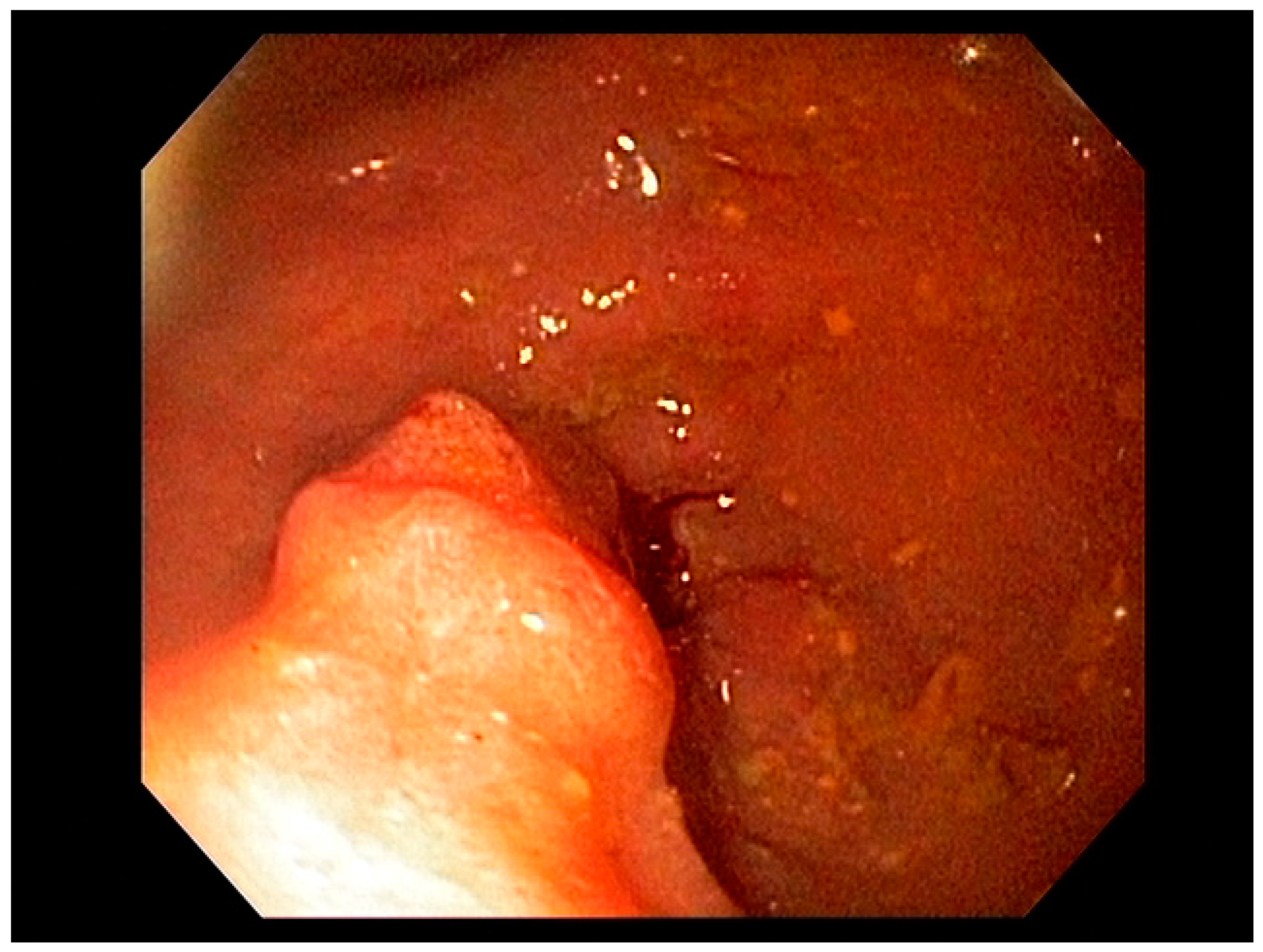 Cancers 13 00582 g009