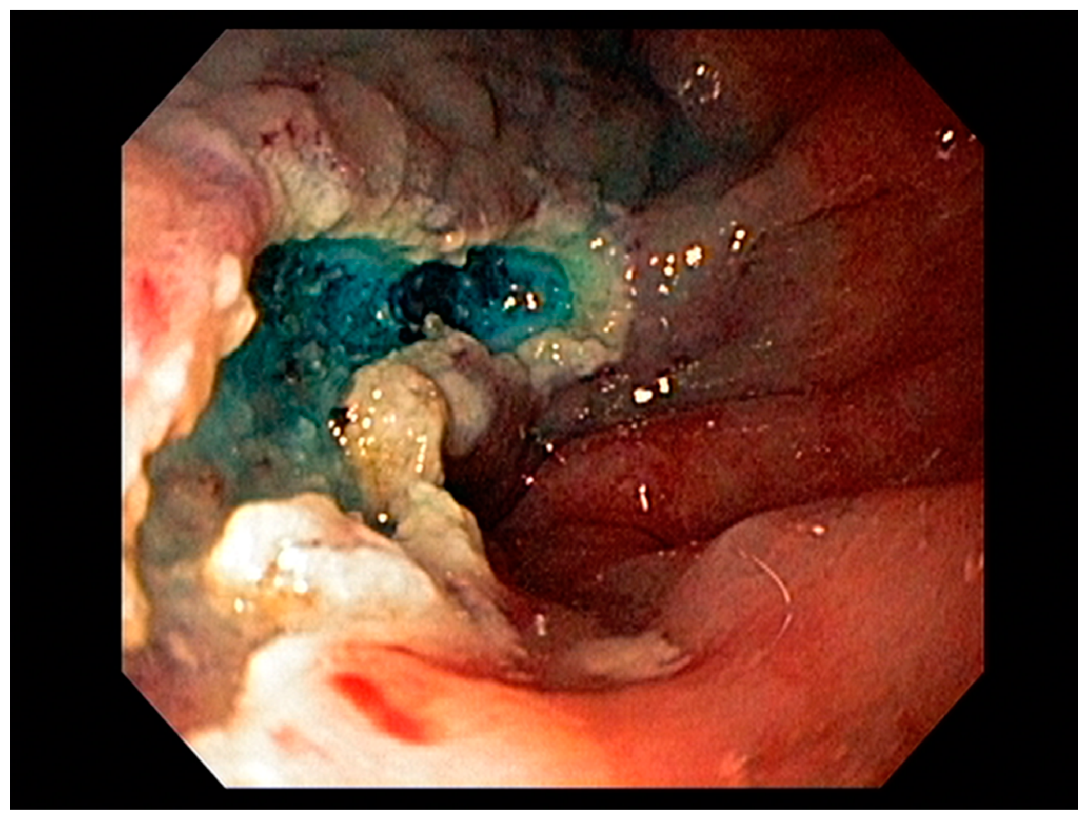 Cancers 13 00582 g010