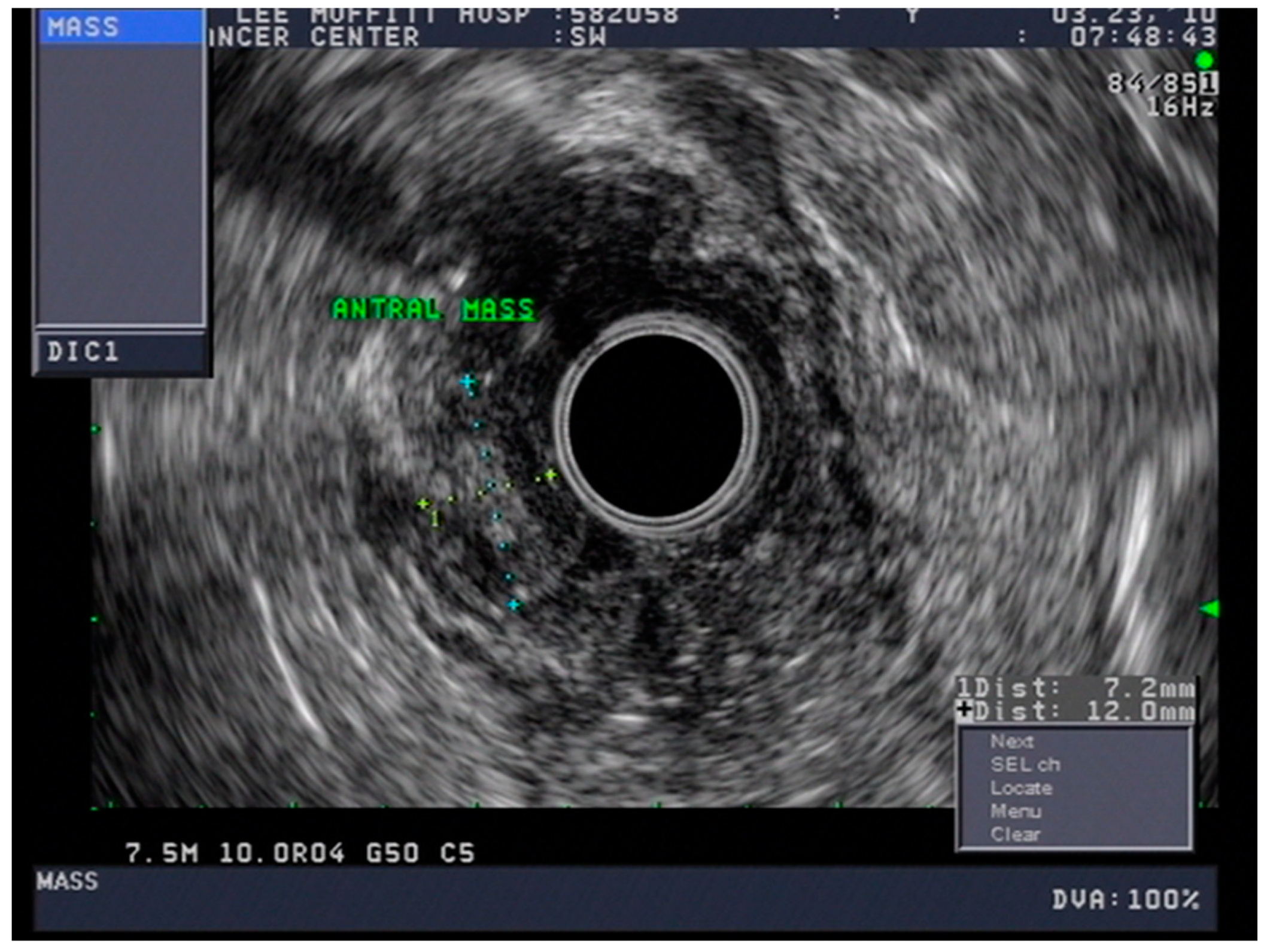 Cancers 13 00582 g011