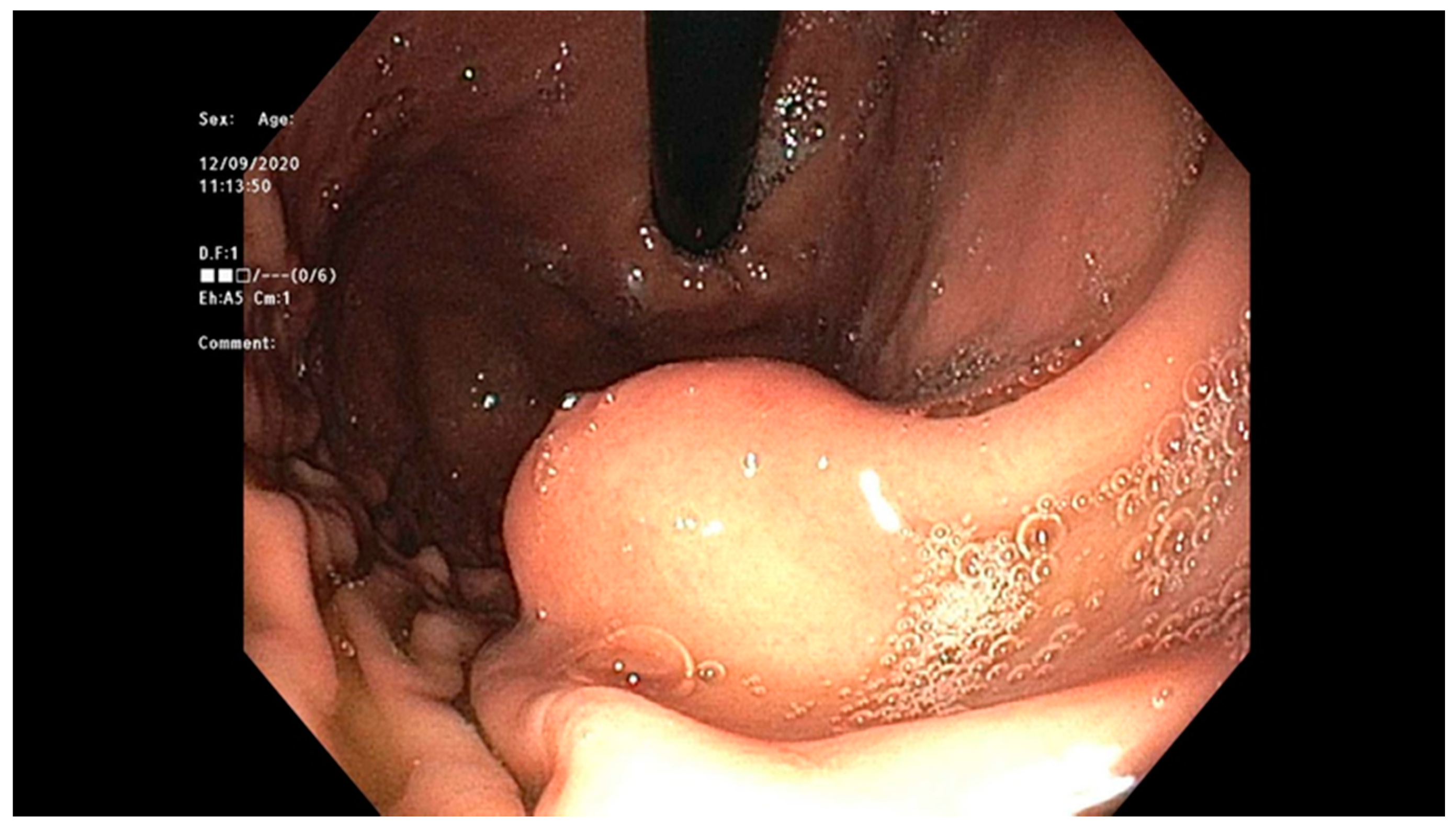 Cancers 13 00582 g012