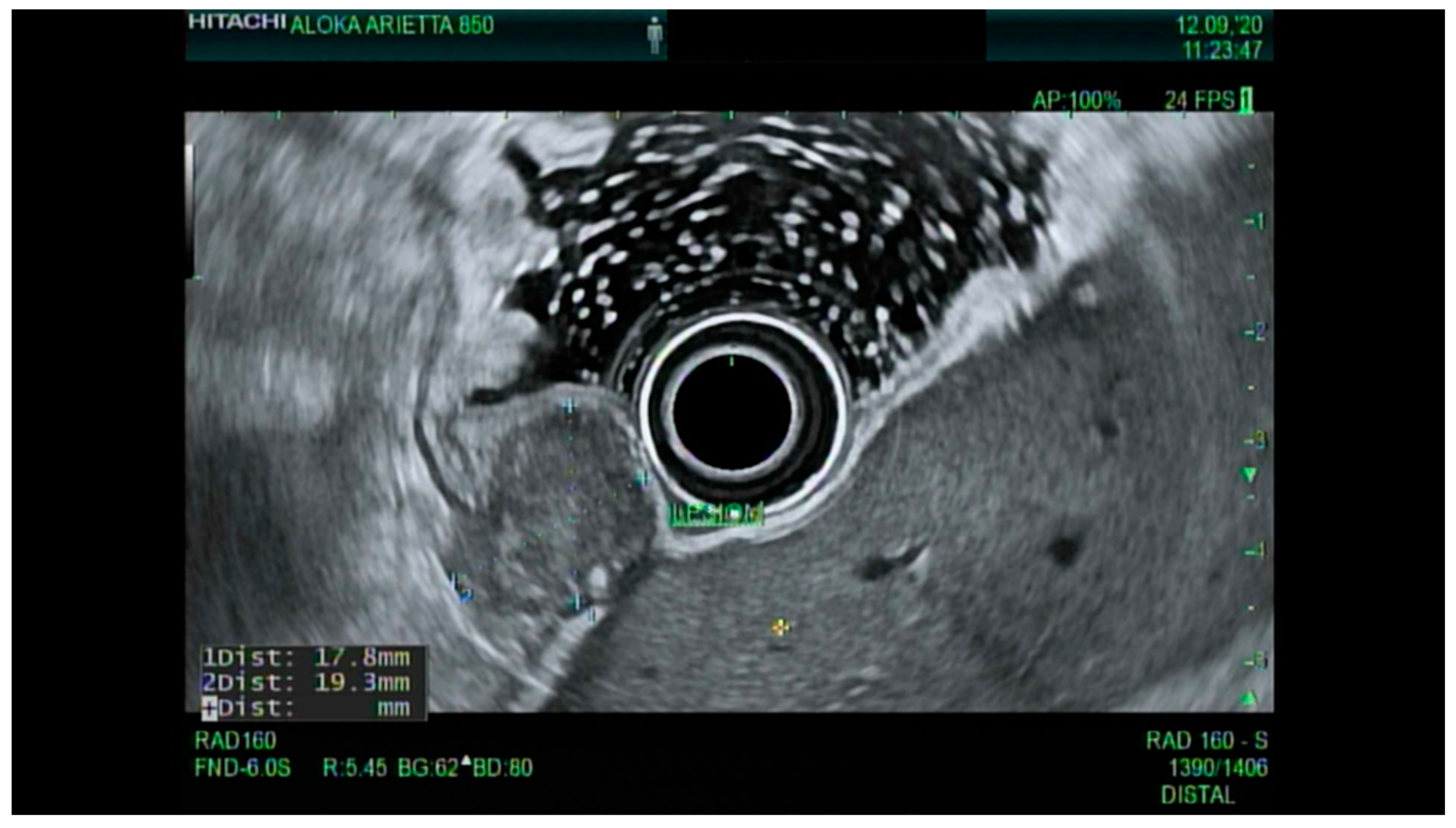 Cancers 13 00582 g013