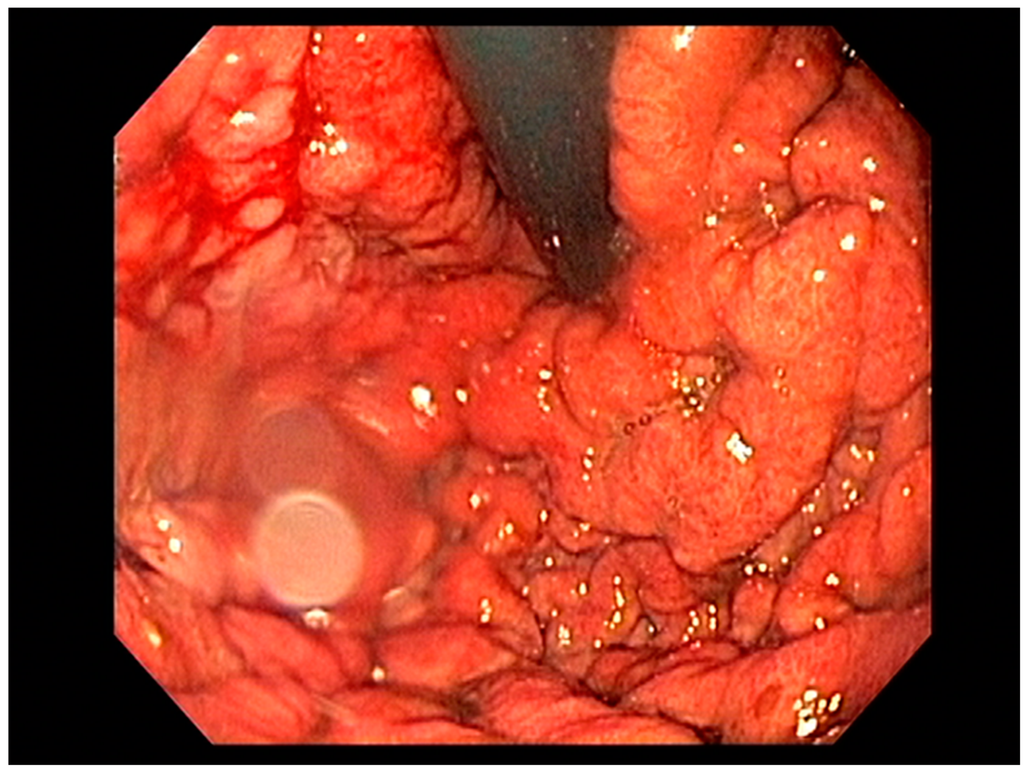 Cancers 13 00582 g014