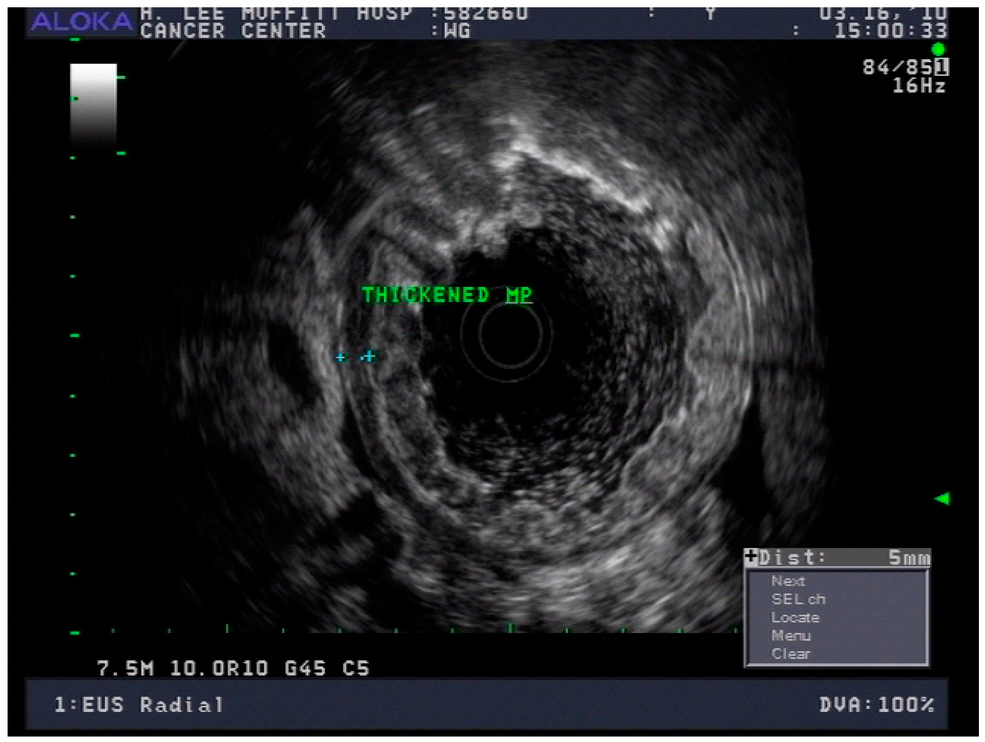 Cancers 13 00582 g015