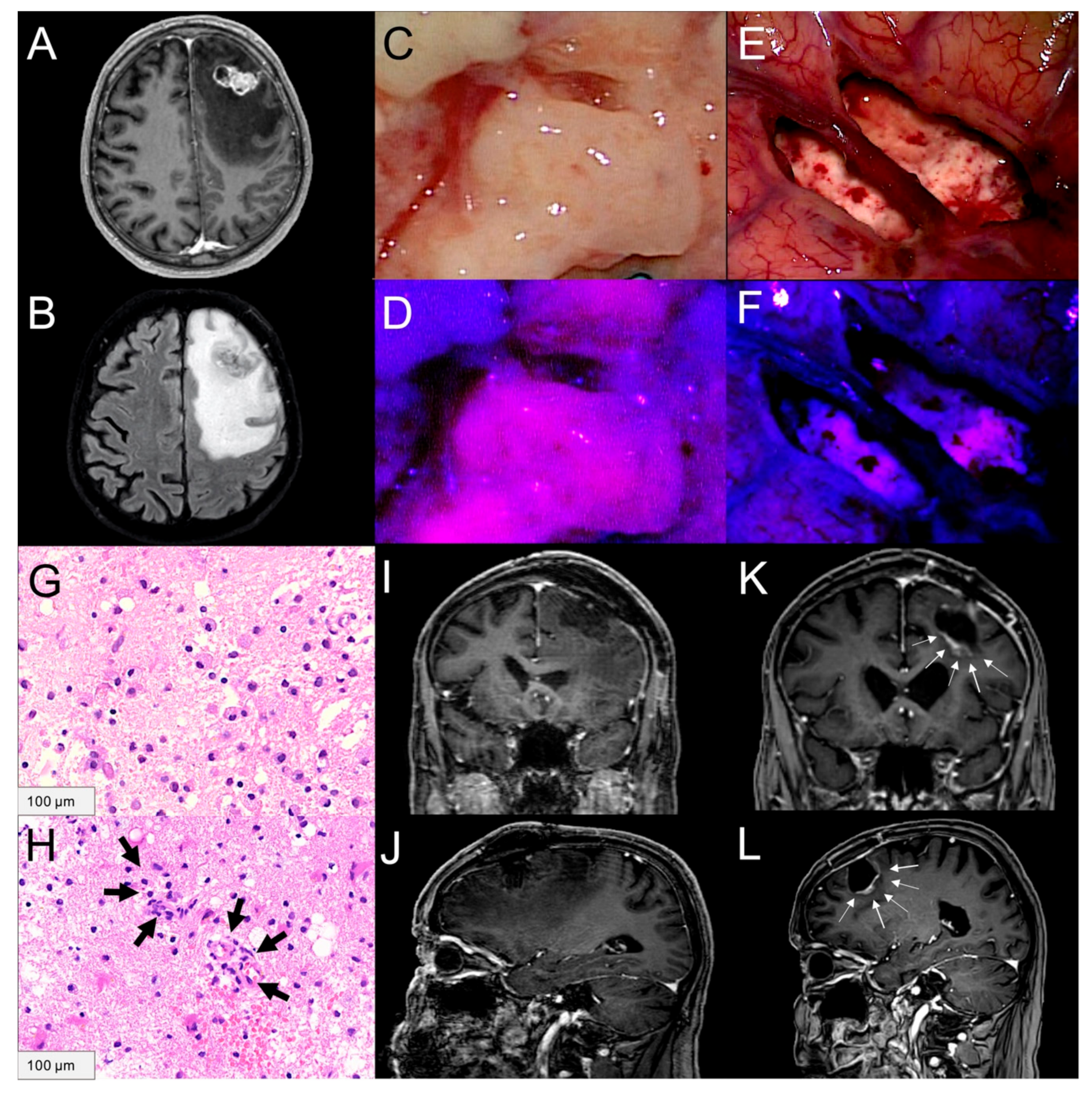 Cancers 13 00603 g003