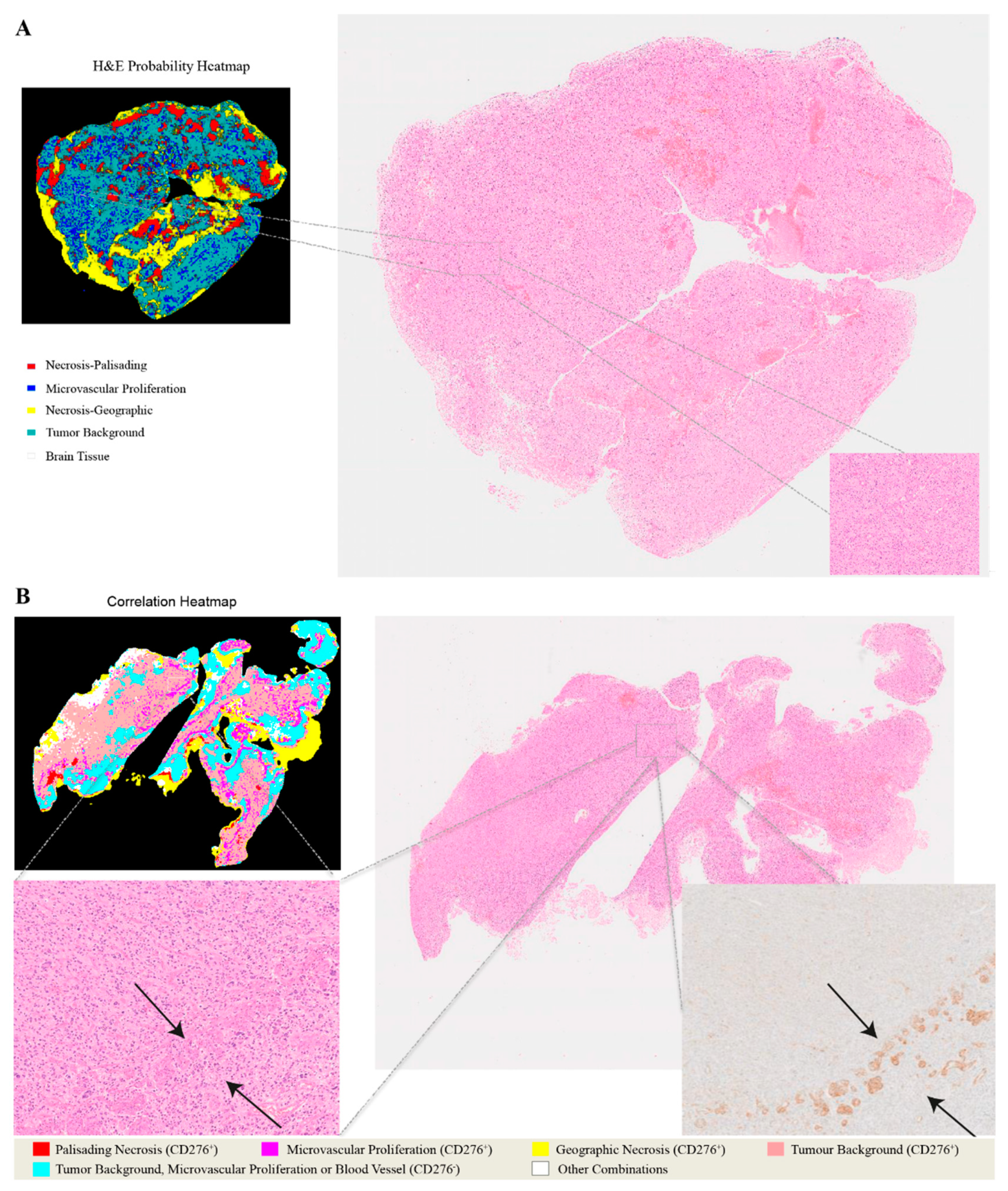 Cancers 13 00617 g004