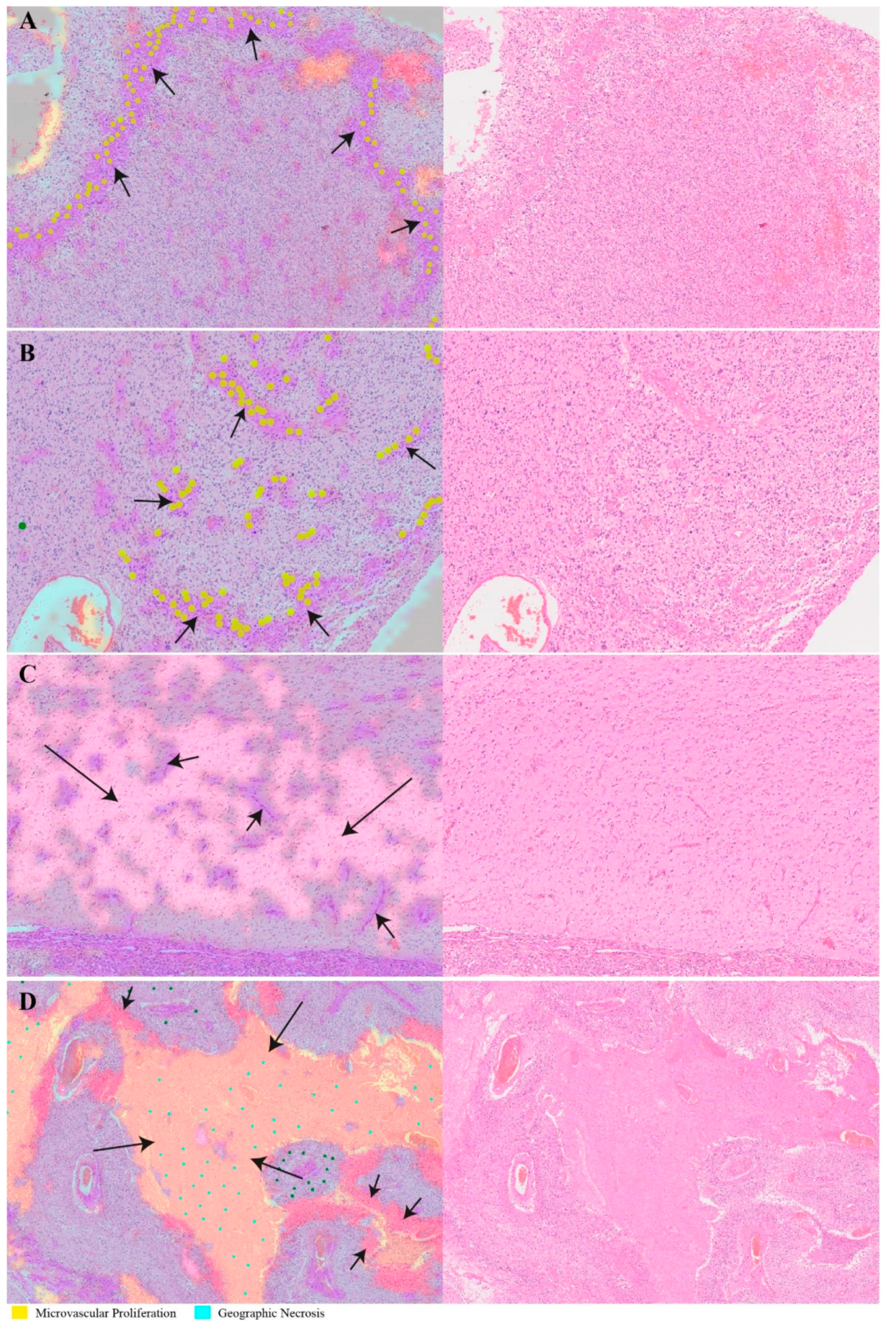 Cancers 13 00617 g005