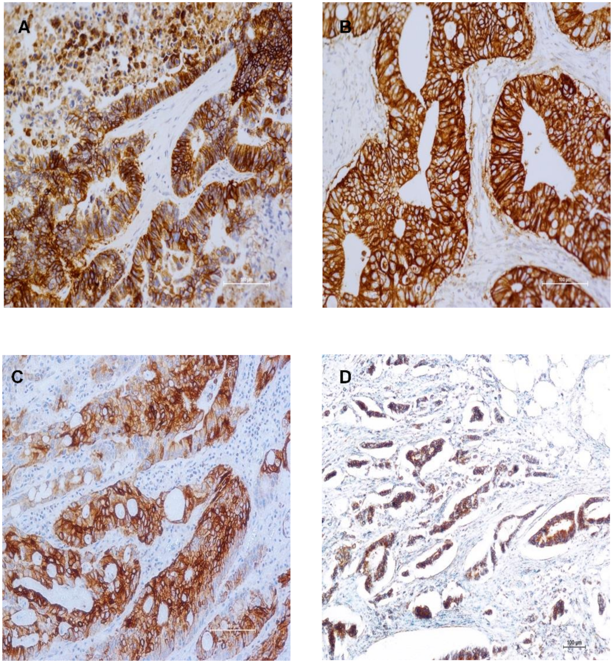 Cancers 13 00638 g001