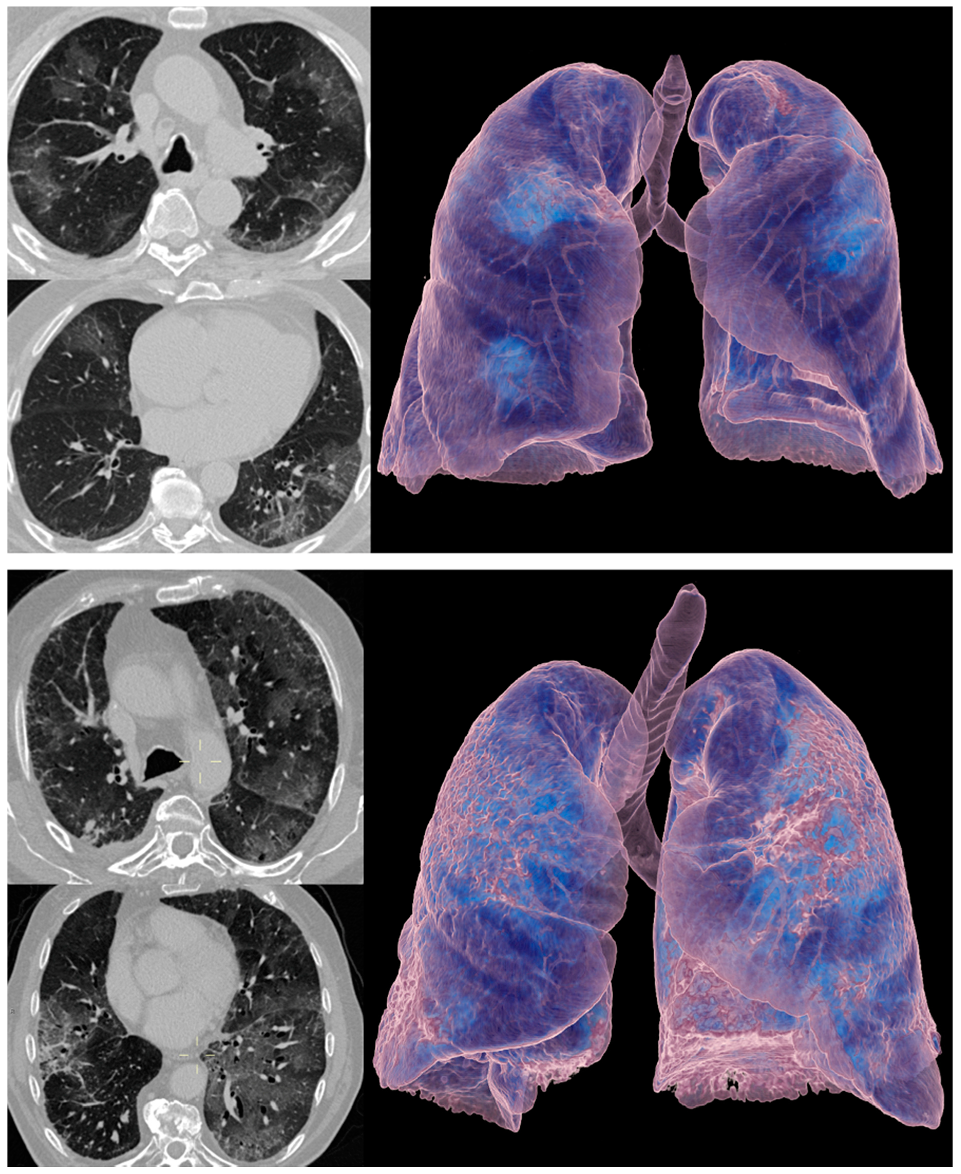 Cancers 13 00652 g003 Cancers 13 00652 g003