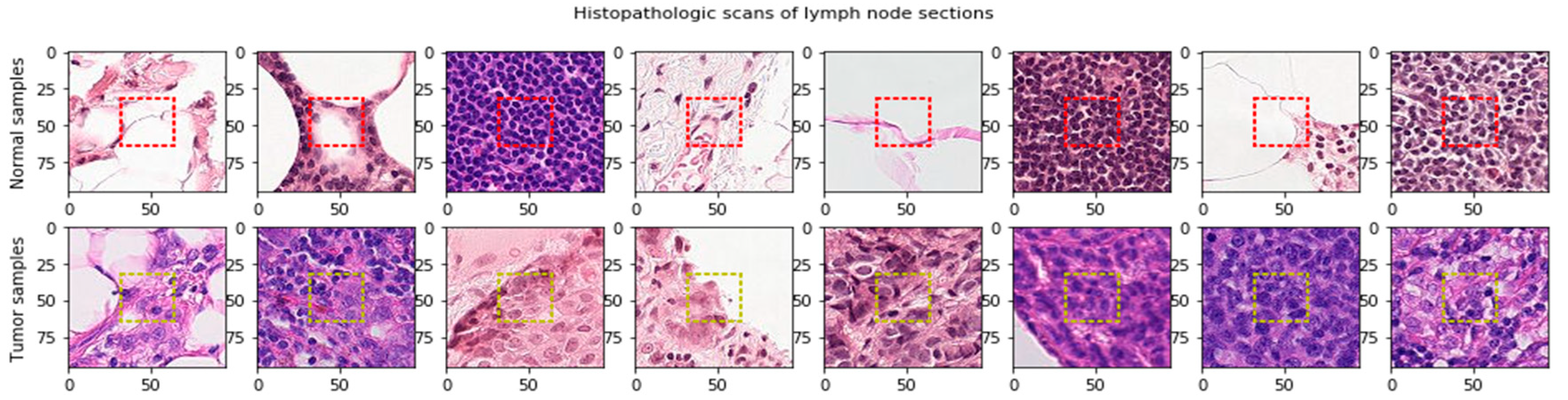 Cancers 13 00661 g003