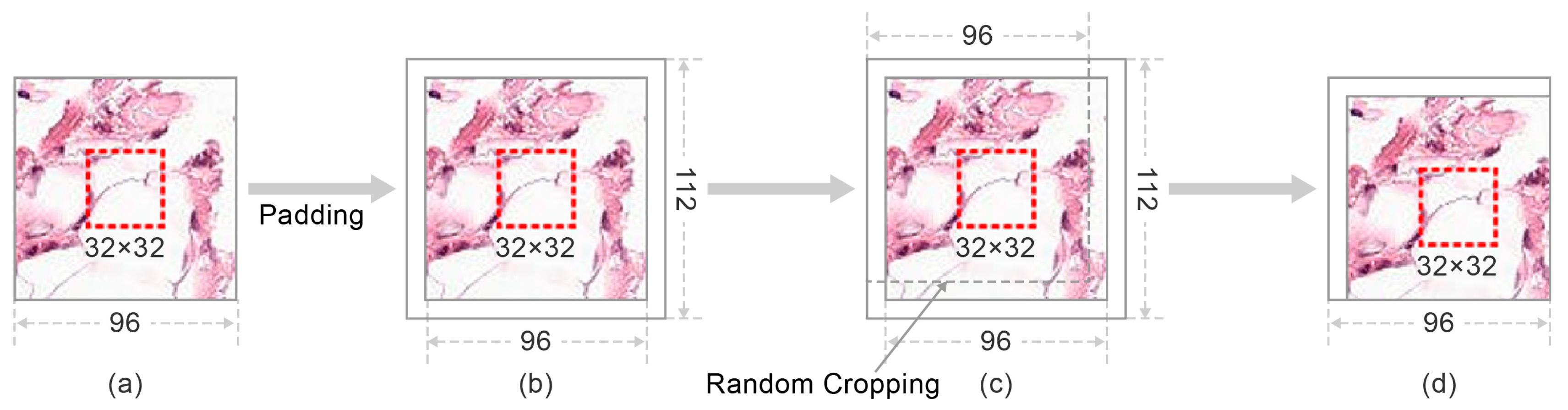 Cancers 13 00661 g004