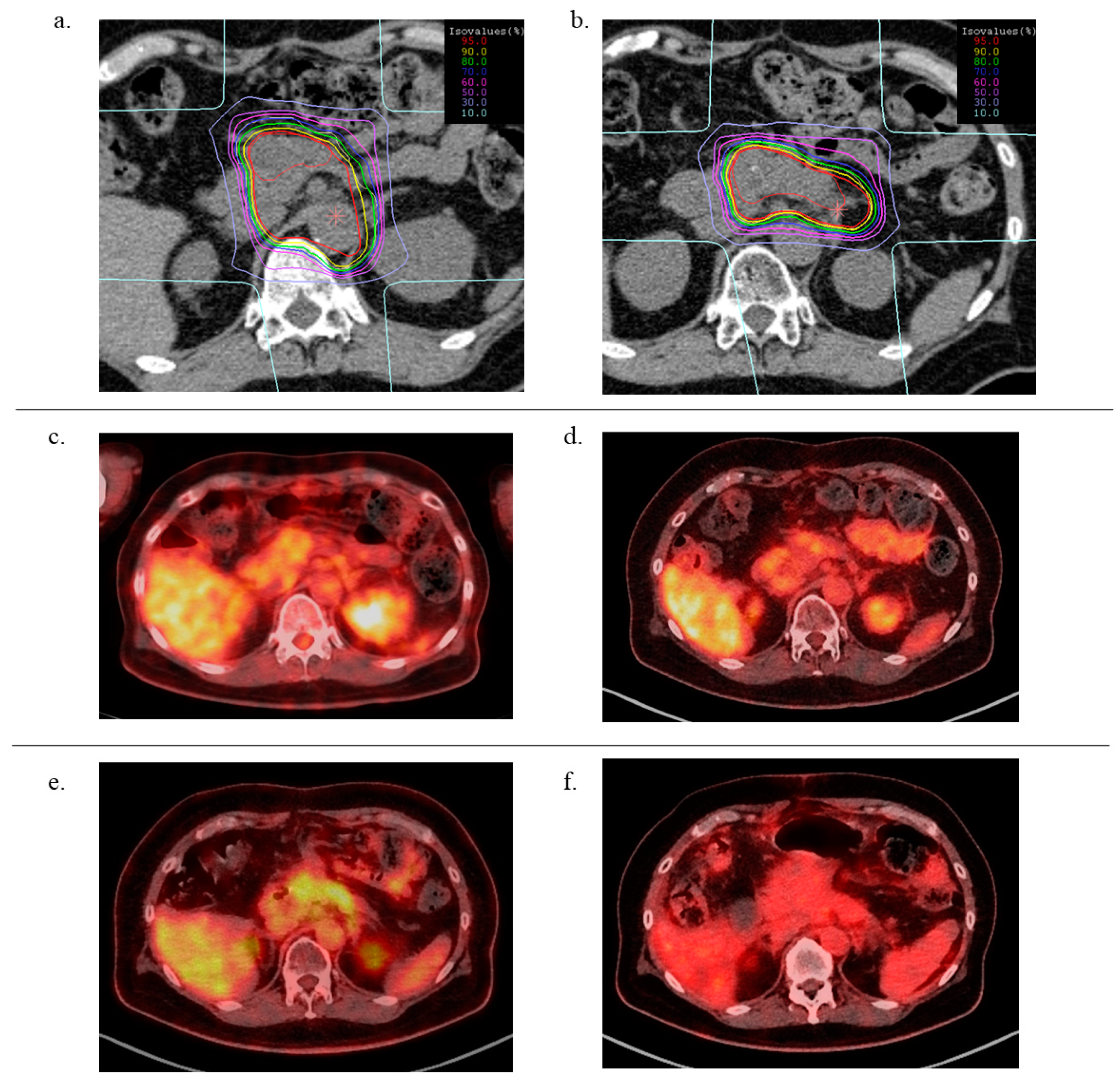 Cancers 13 00665 g001