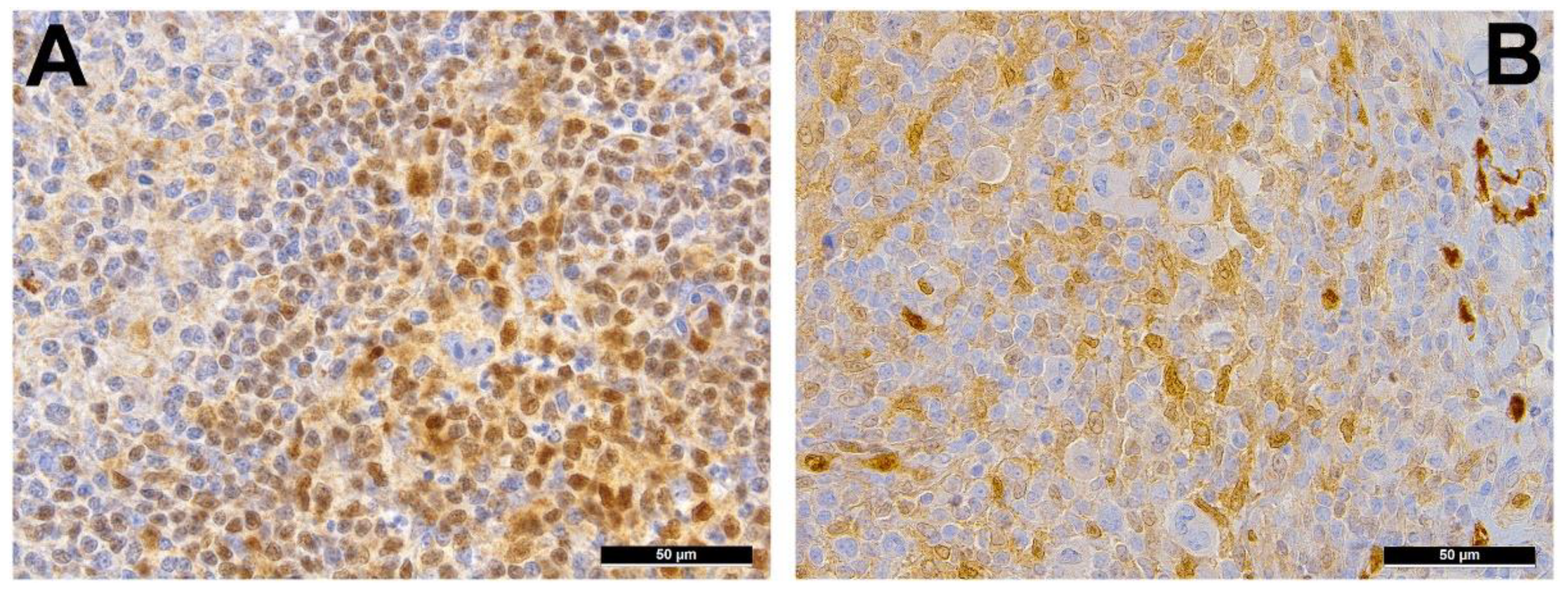 Cancers 13 00682 g003