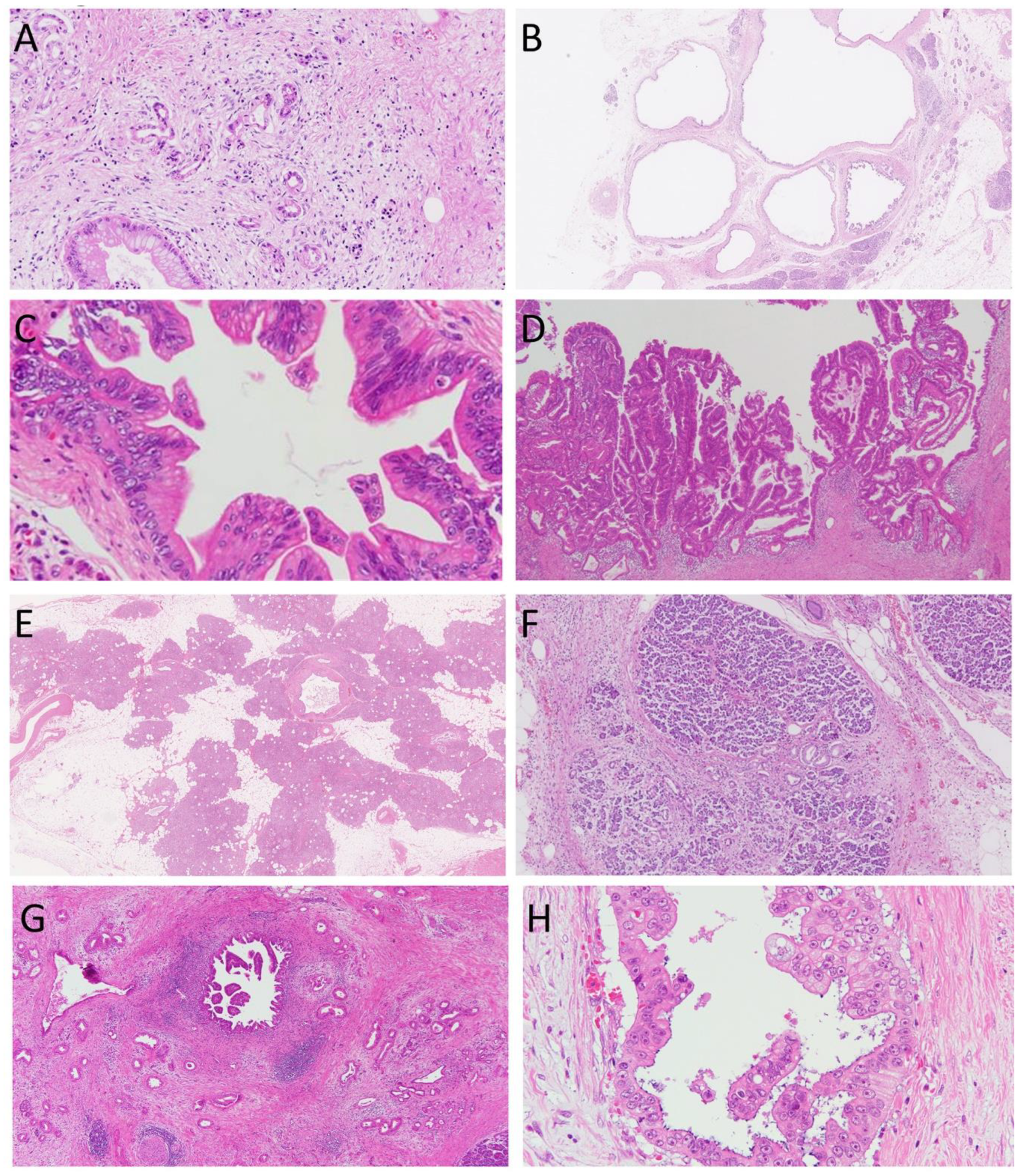 Cancers 13 00686 g001