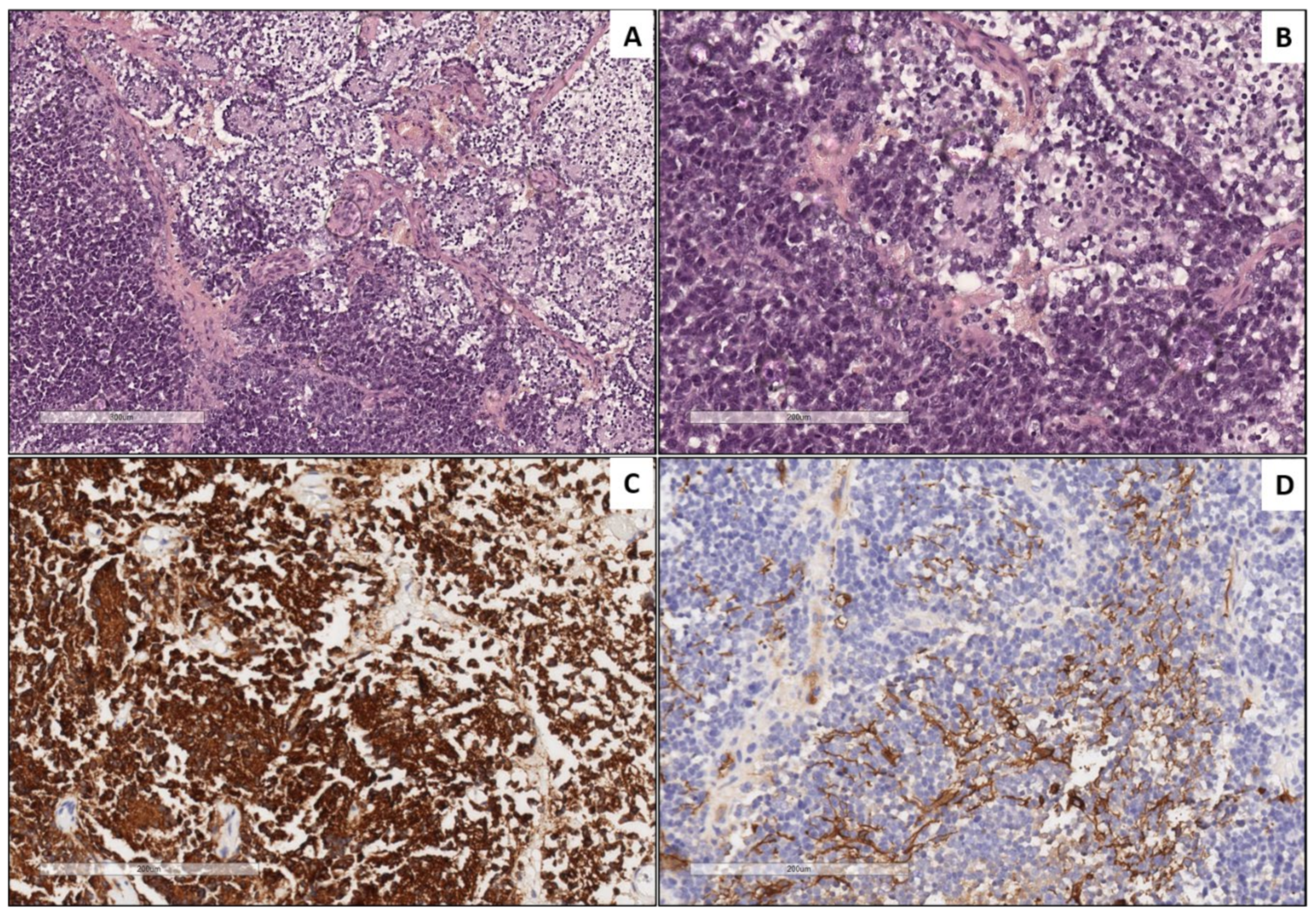 Cancers 13 00706 g002 Cancers 13 00706 g002