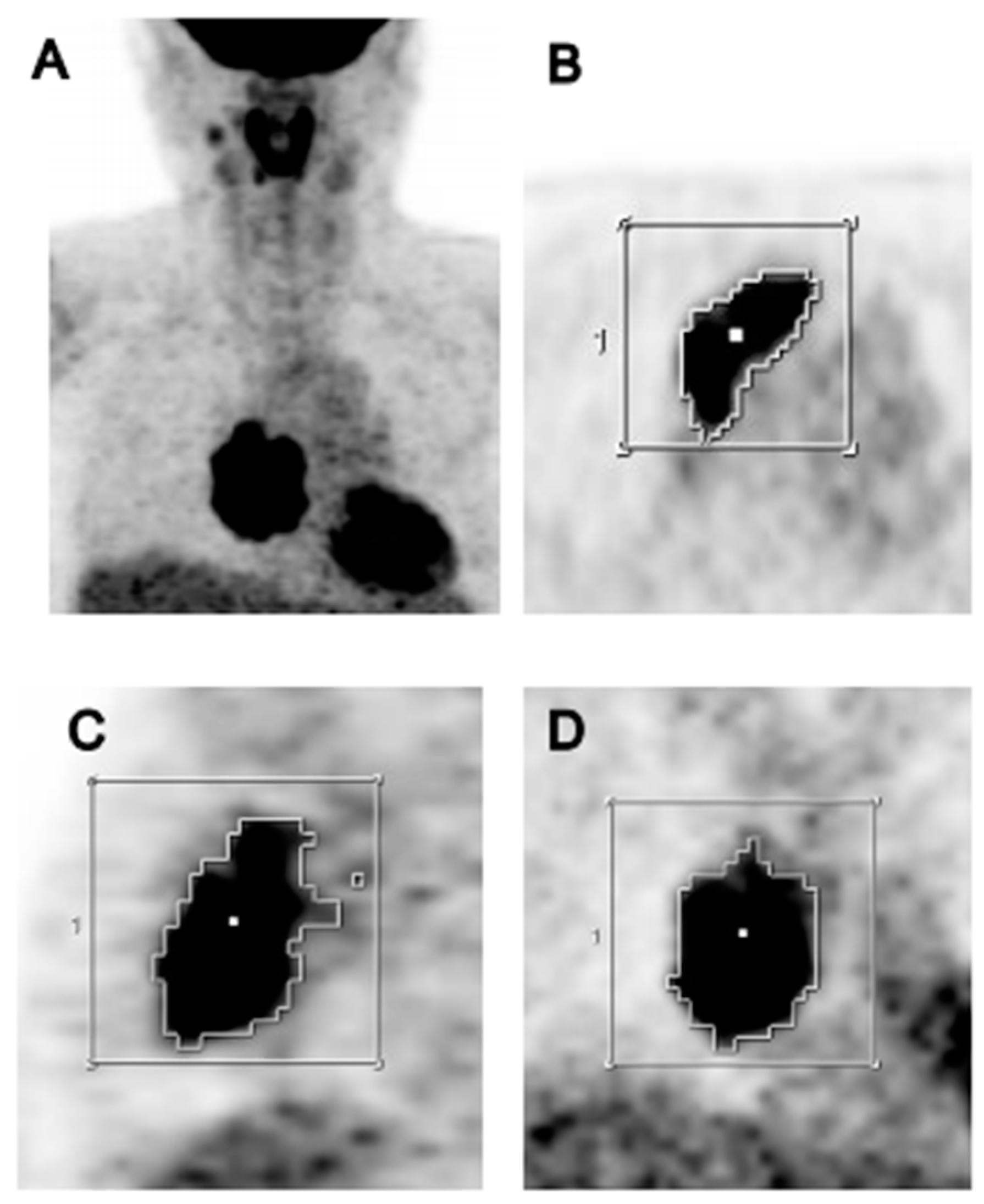 Cancers 13 00712 g001