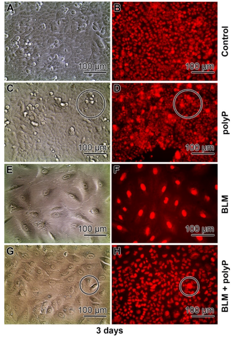 Cancers 13 00750 g006