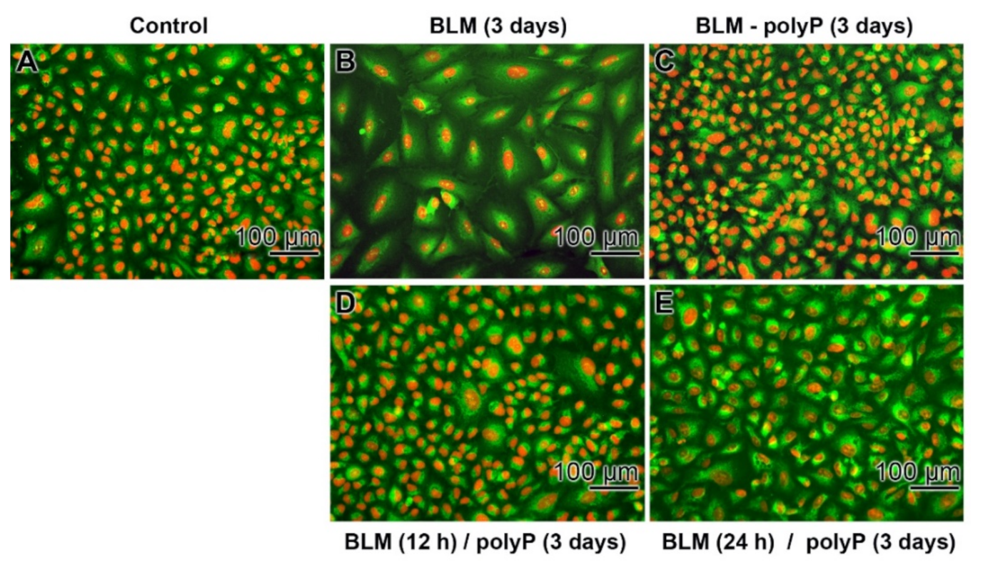 Cancers 13 00750 g008