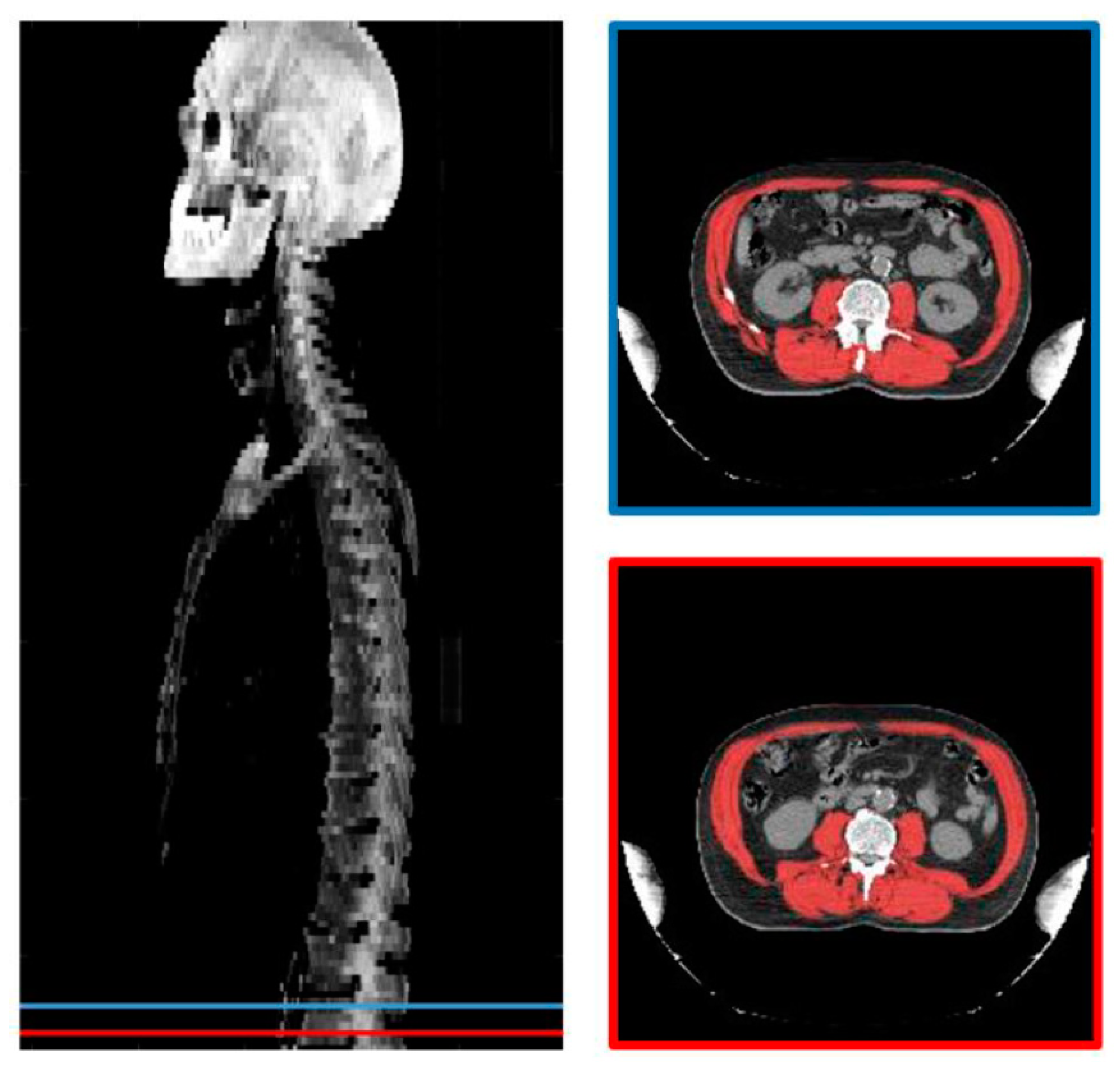 Cancers 13 00753 g001