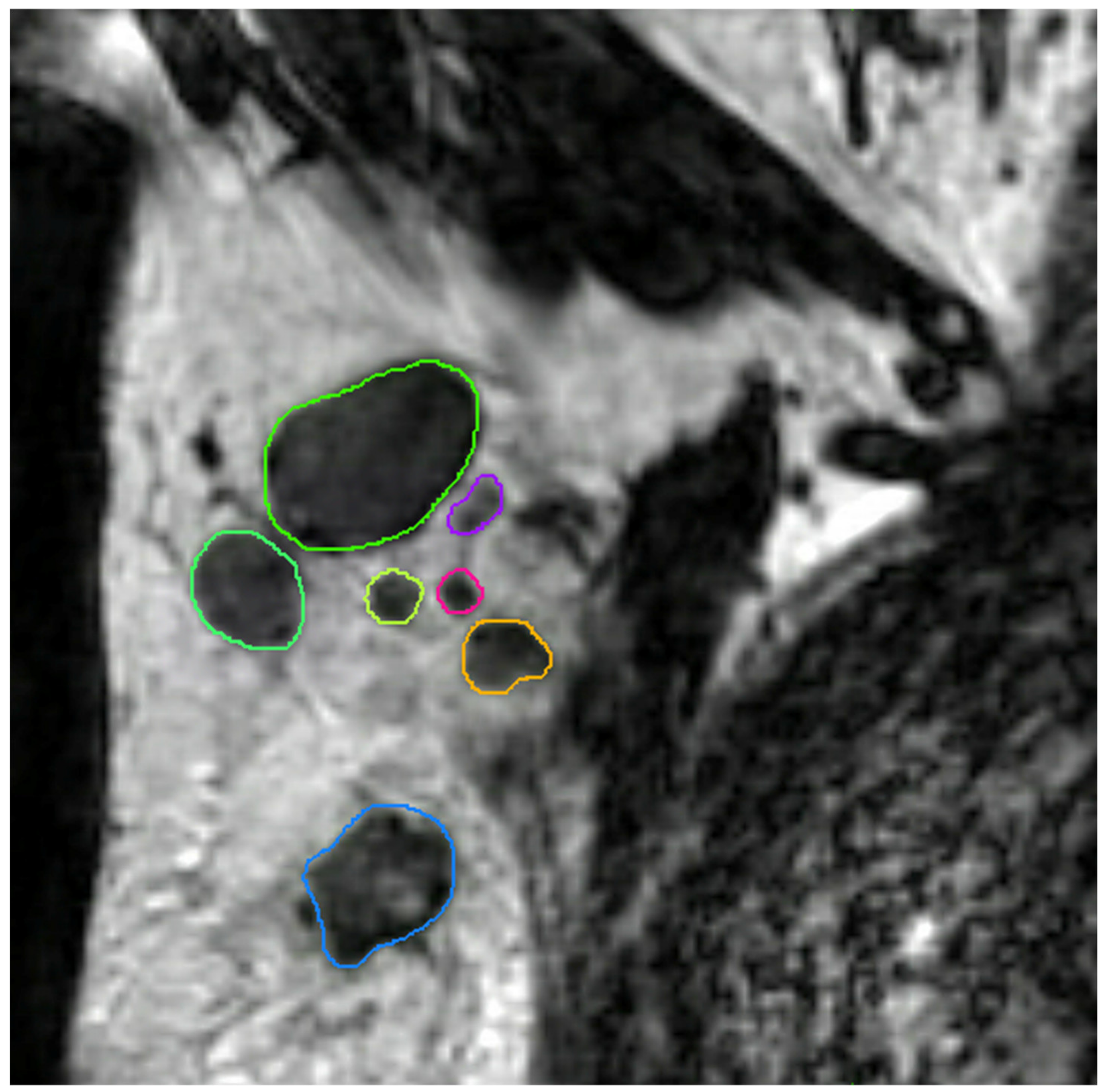 Cancers 13 00757 g004