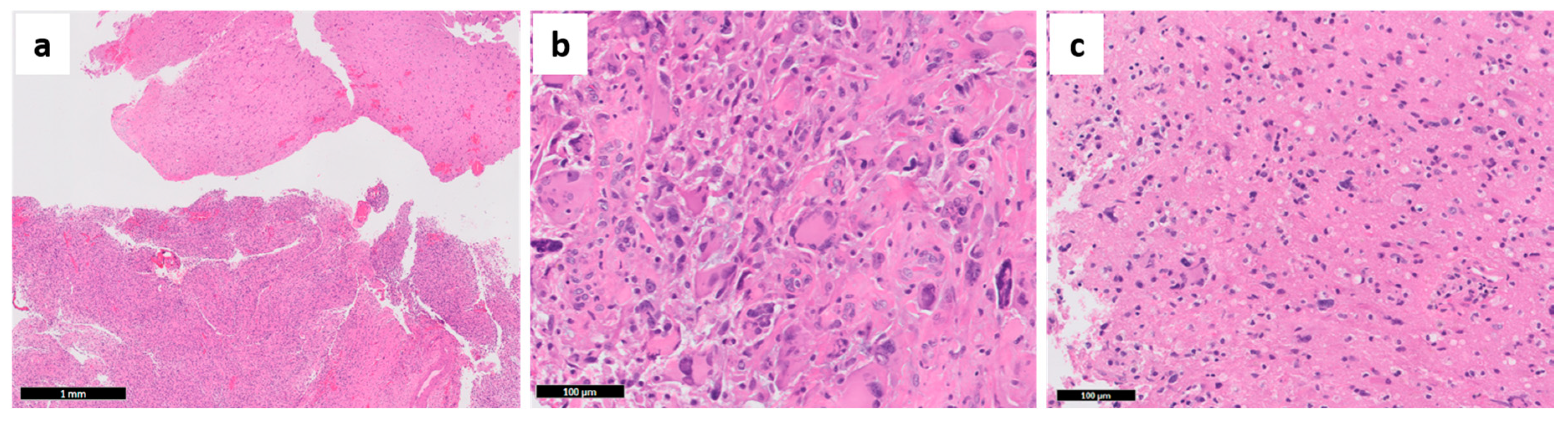 Cancers 13 00761 g004