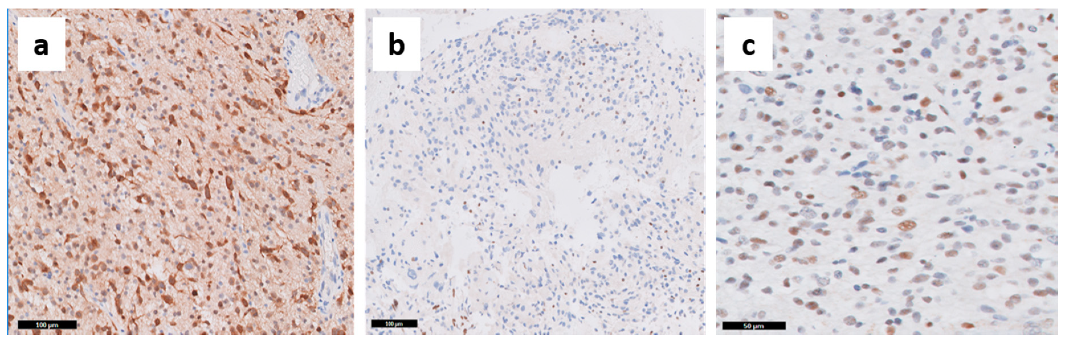 Cancers 13 00761 g005