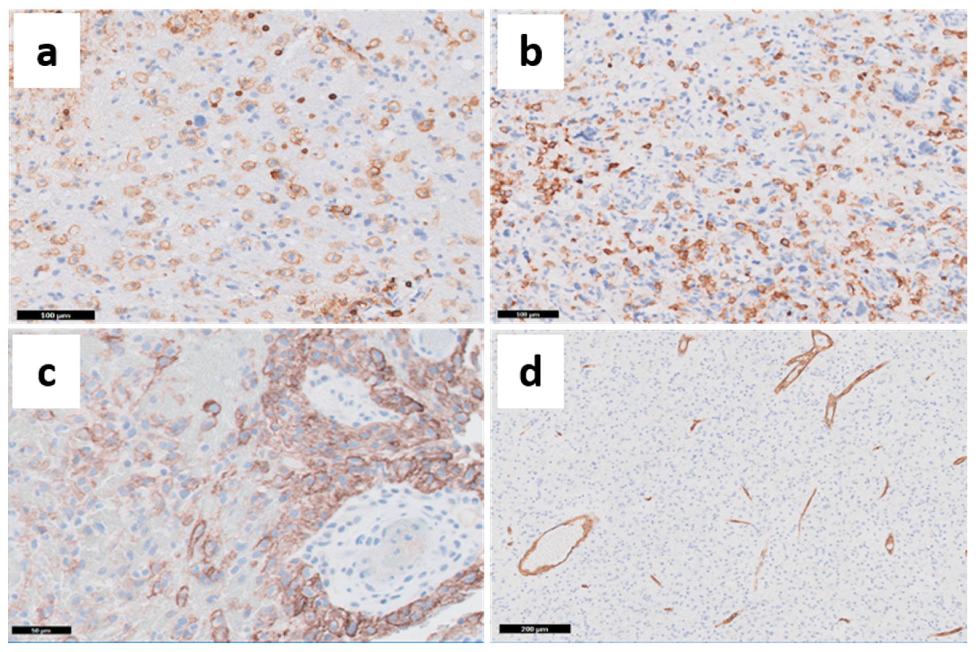 Cancers 13 00761 g006