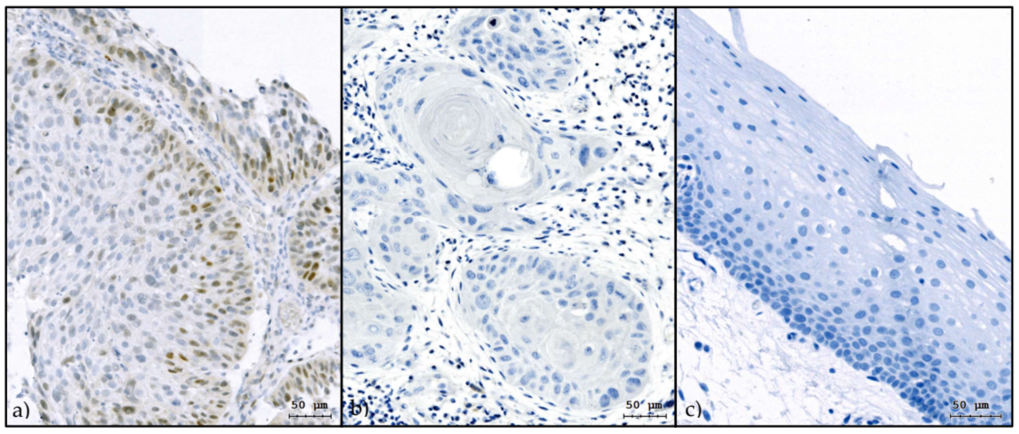 Cancers 13 00772 g001