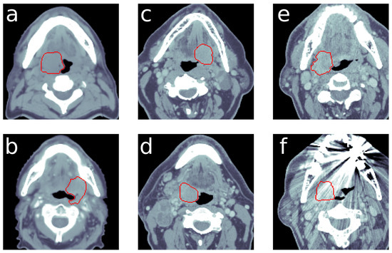 Cancers 13 00786 g0a2