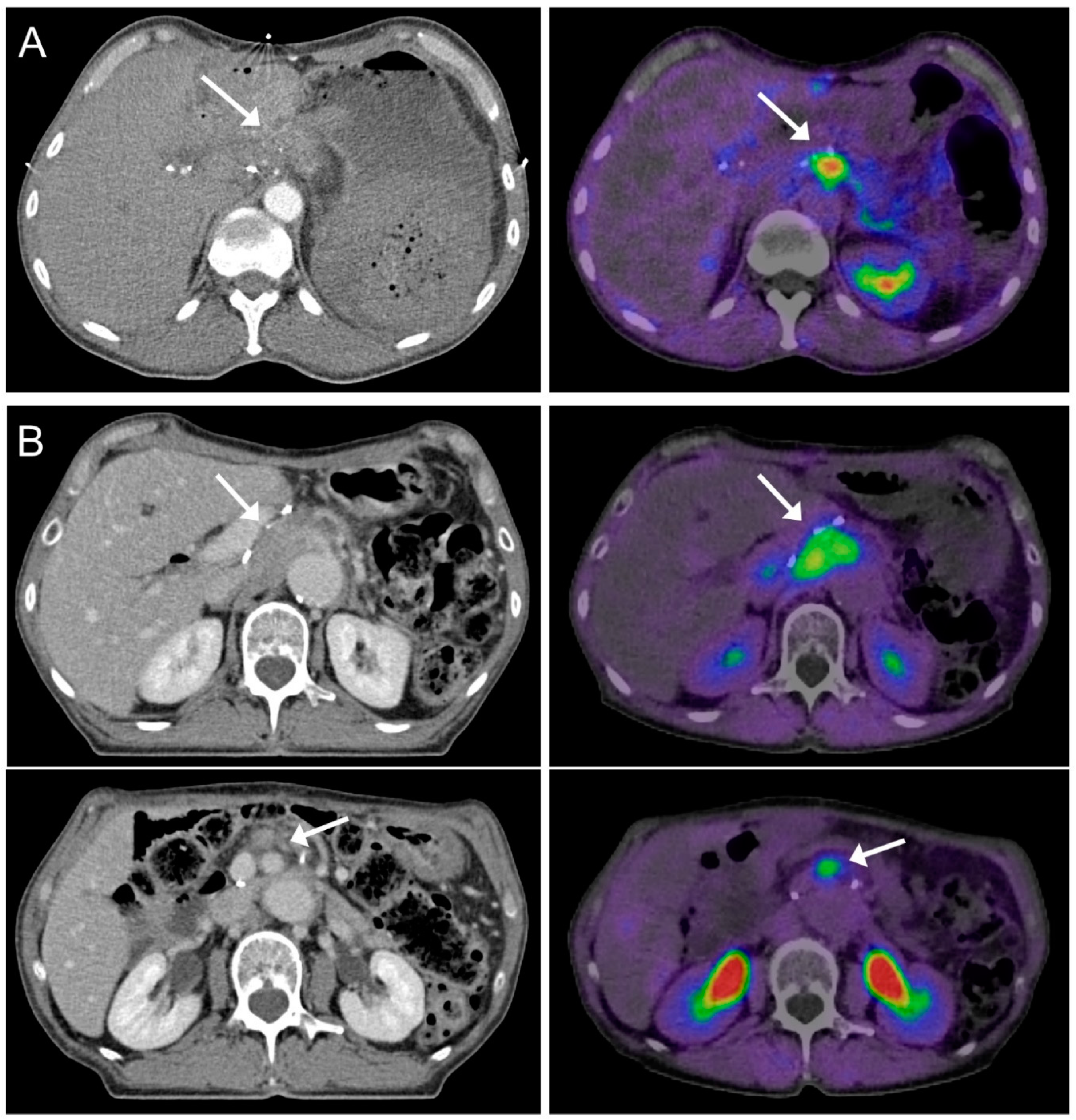 Cancers 13 00796 g002