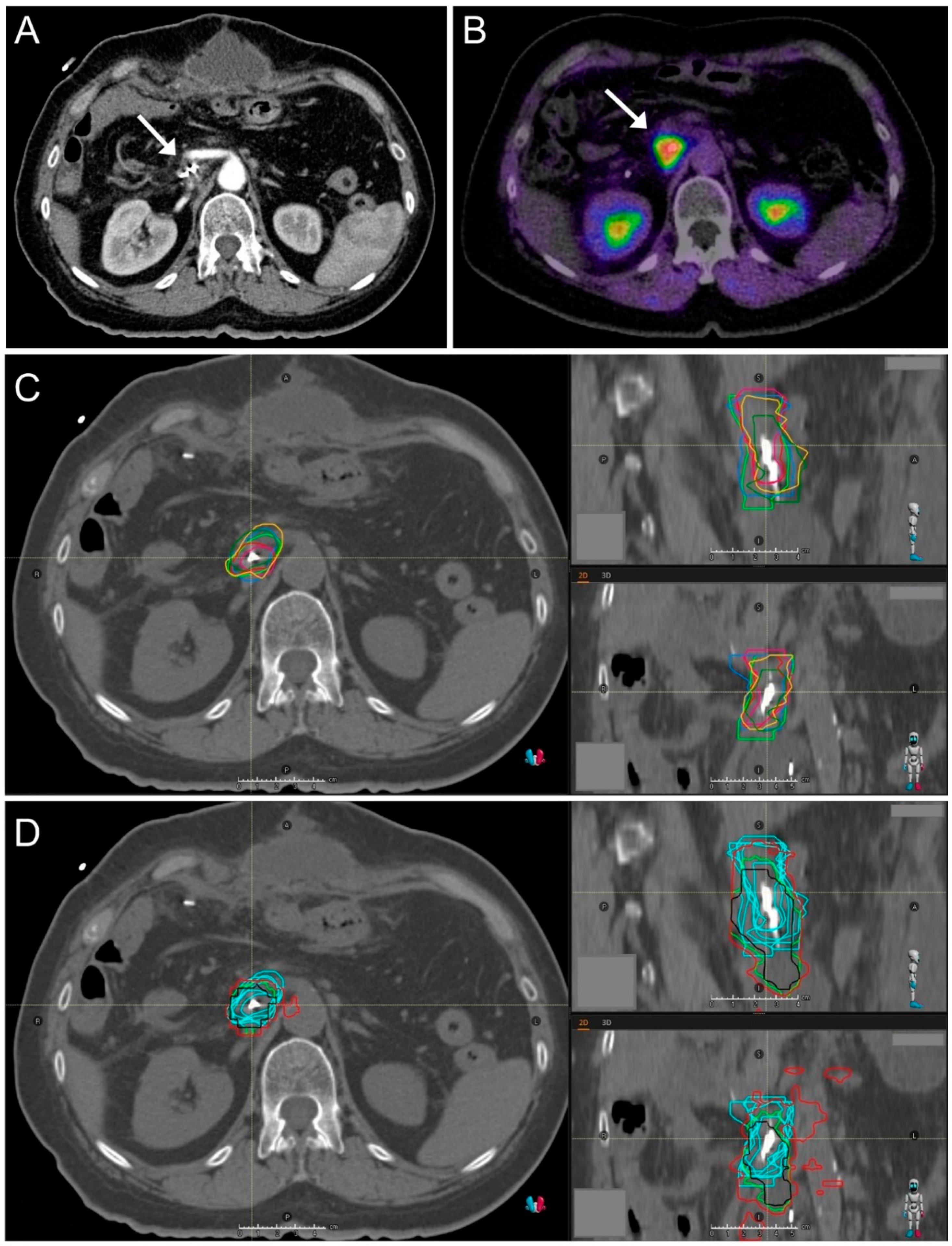 Cancers 13 00796 g003