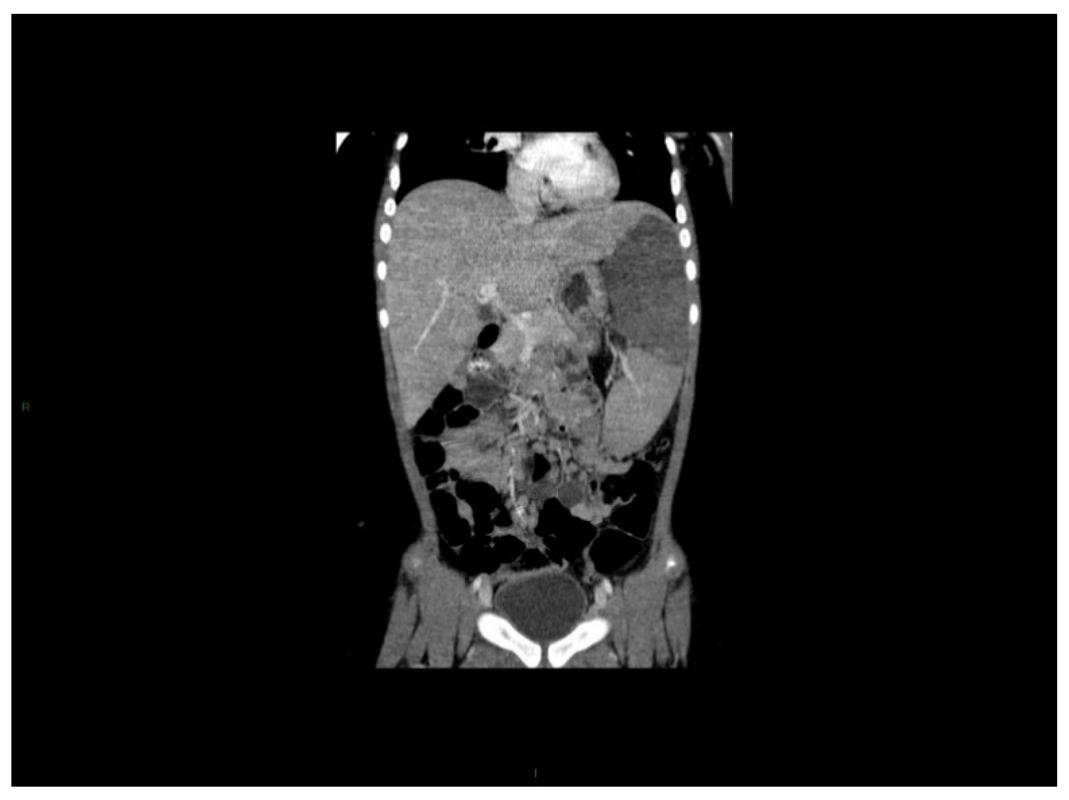 Cancers 13 00798 g005