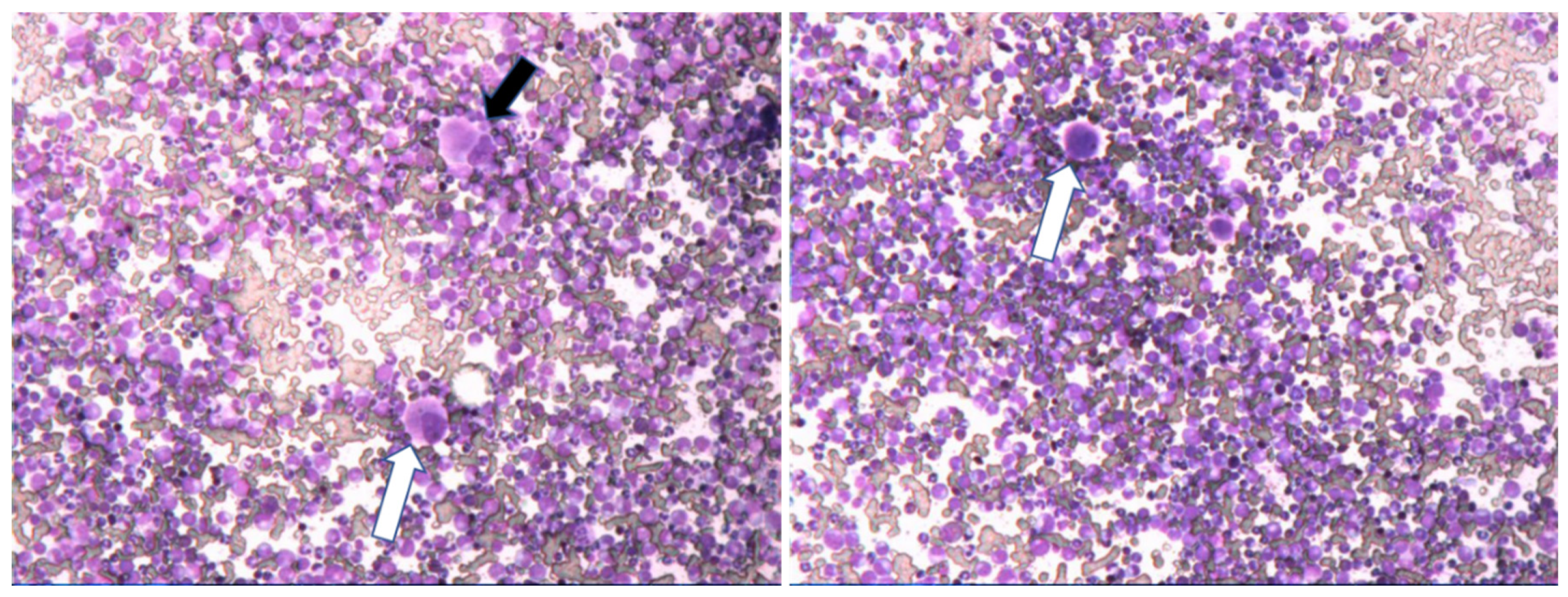 Cancers 13 00798 g006