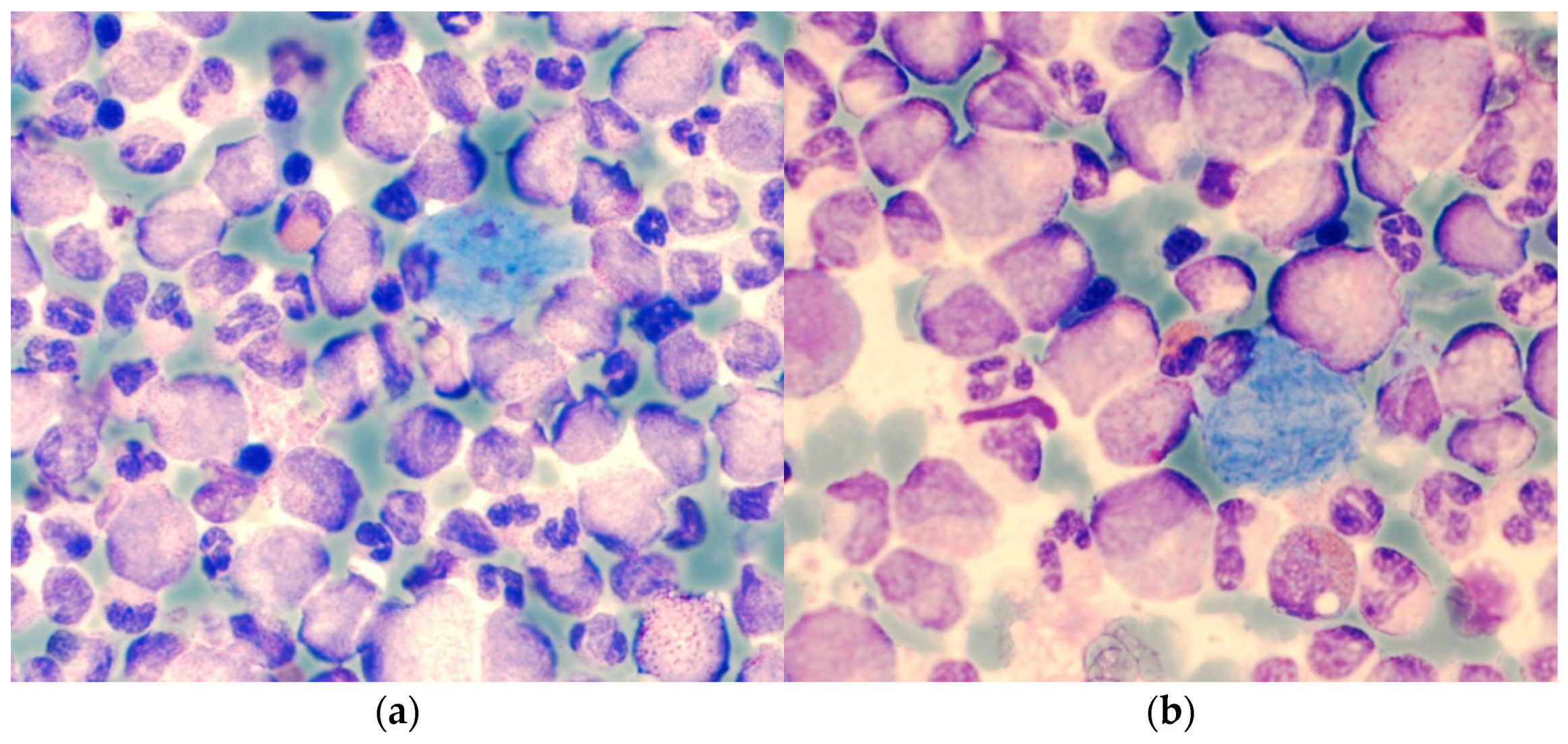 Cancers 13 00798 g008