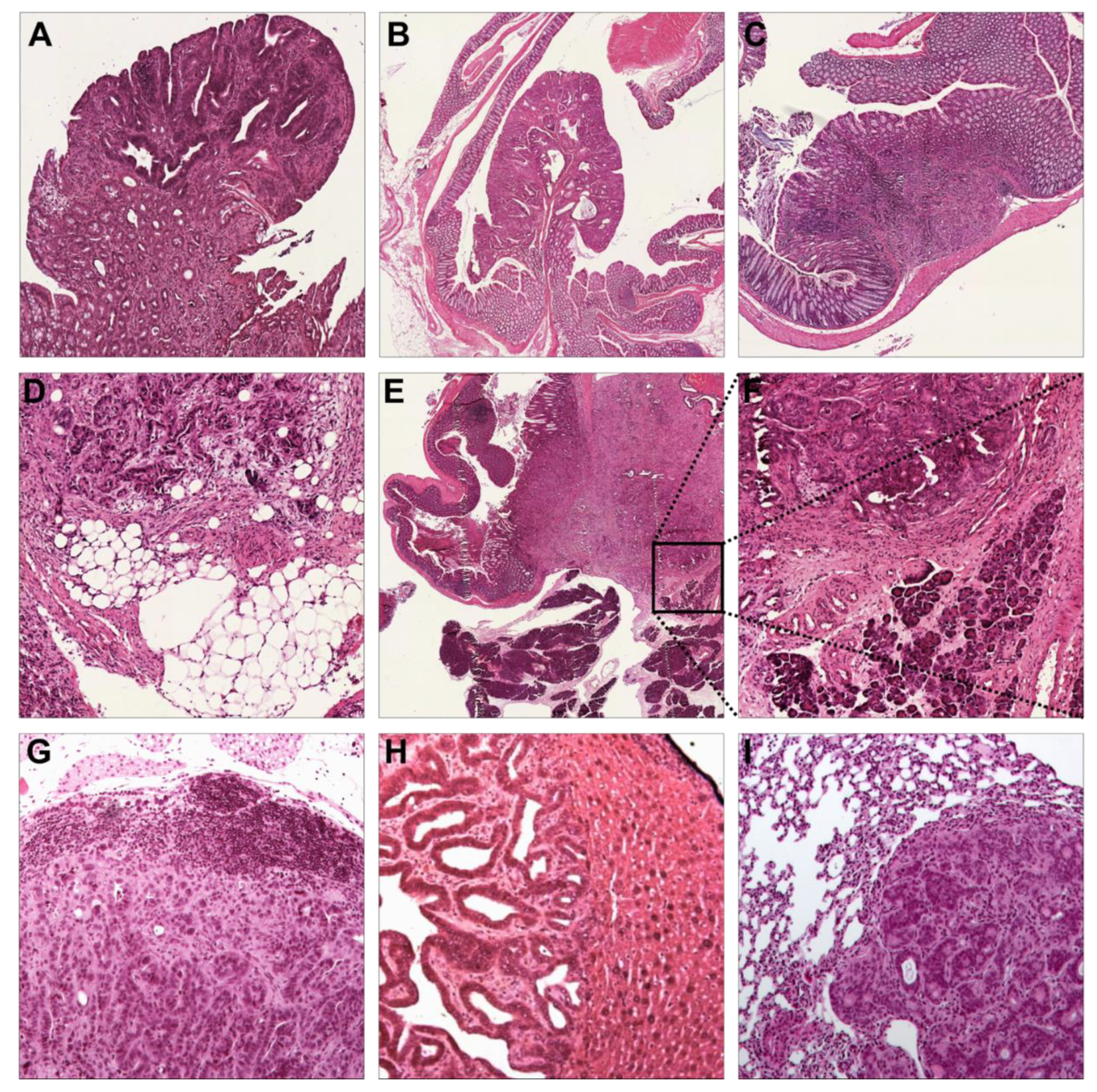 Cancers 13 00808 g002